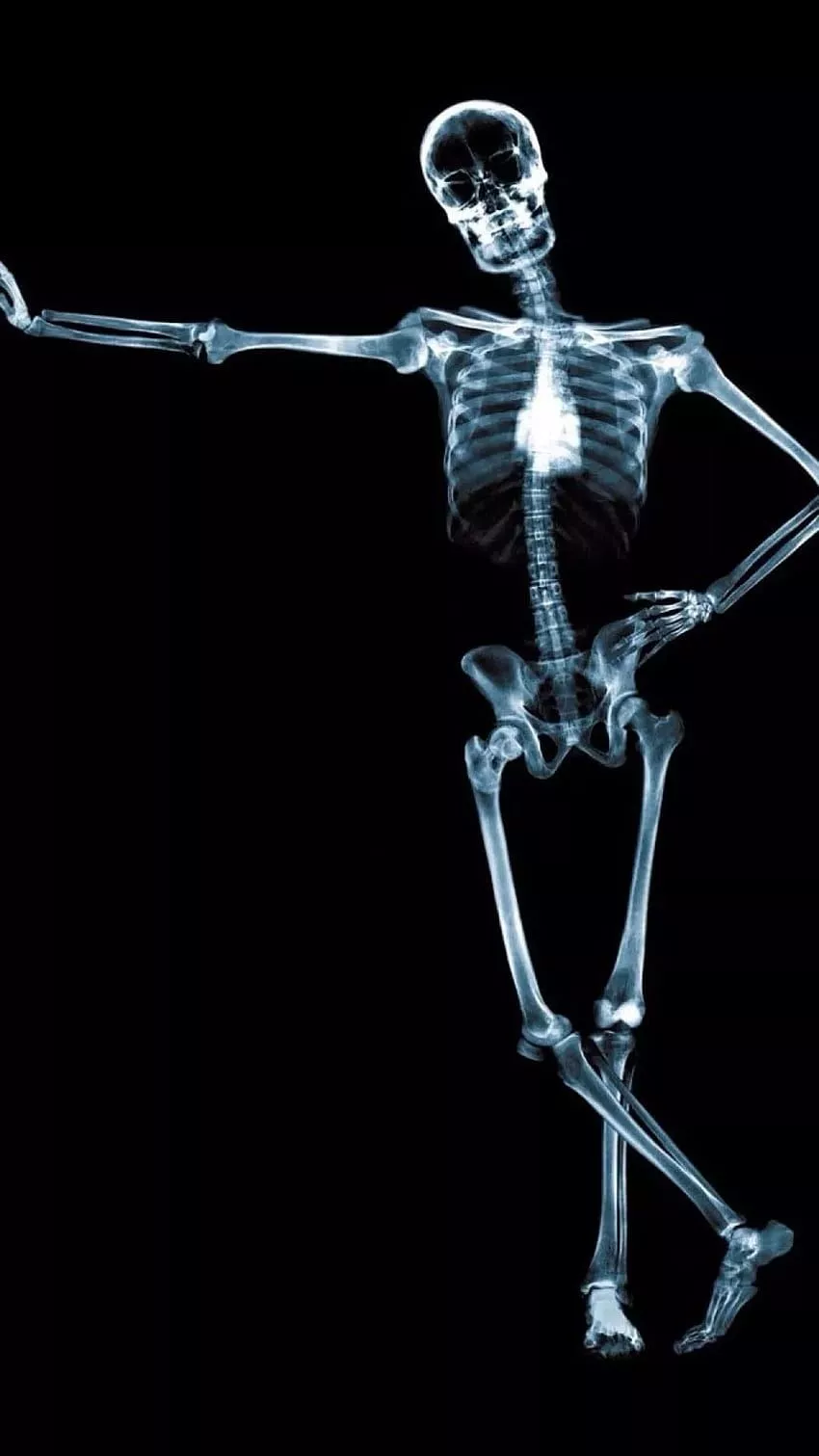 Skeleton iPhone, Medical HD phone