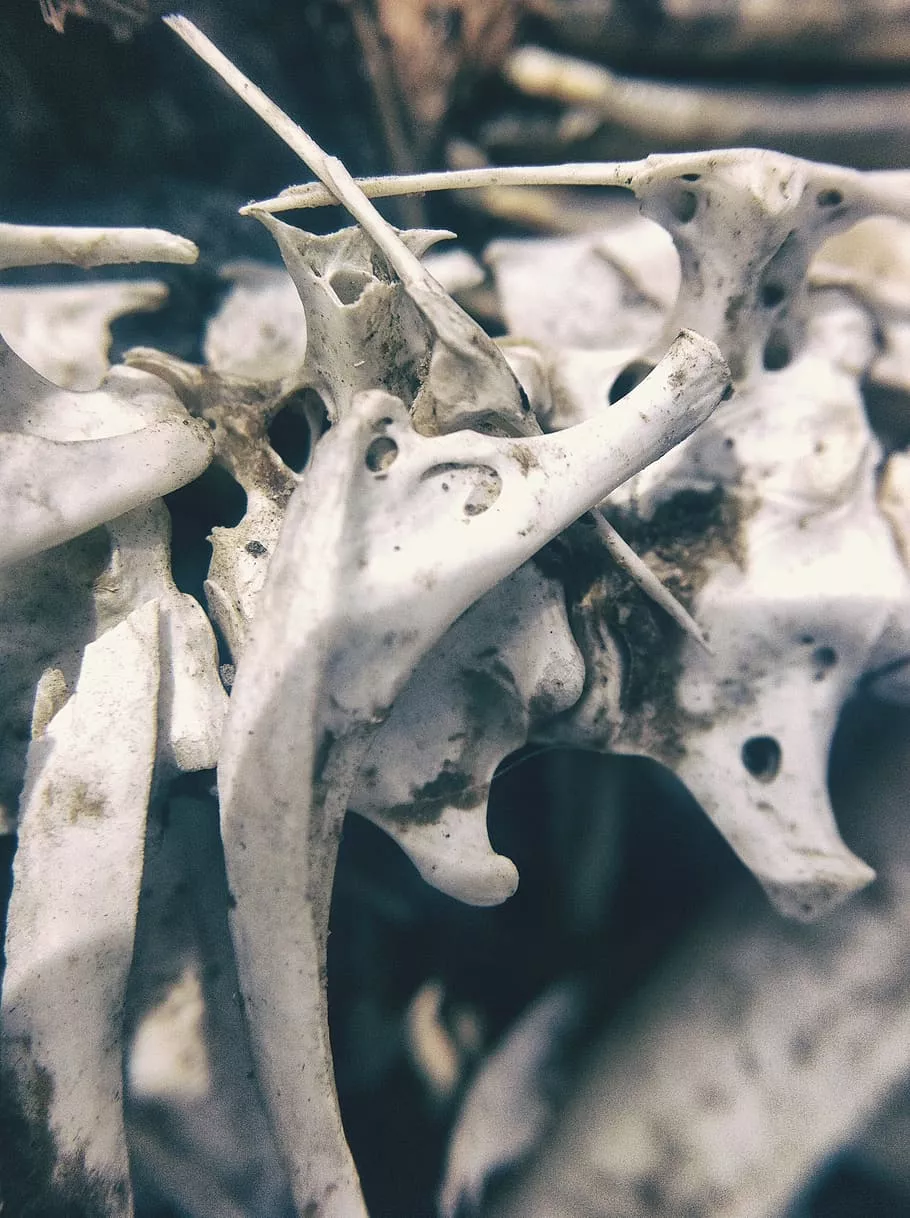 bone, bones, skeleton, anatomy