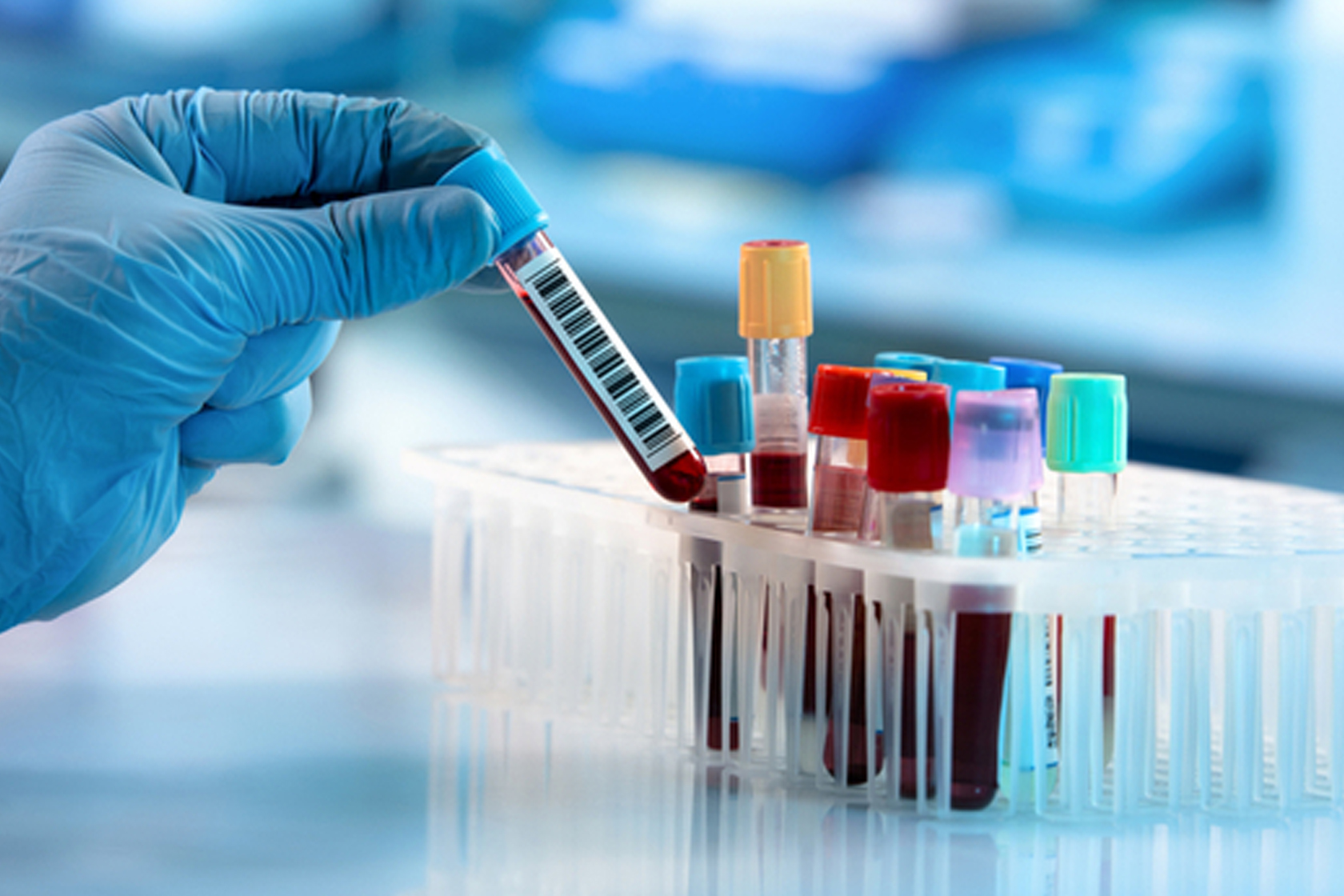 Lab Expert Diagnostics Pvt. Ltd