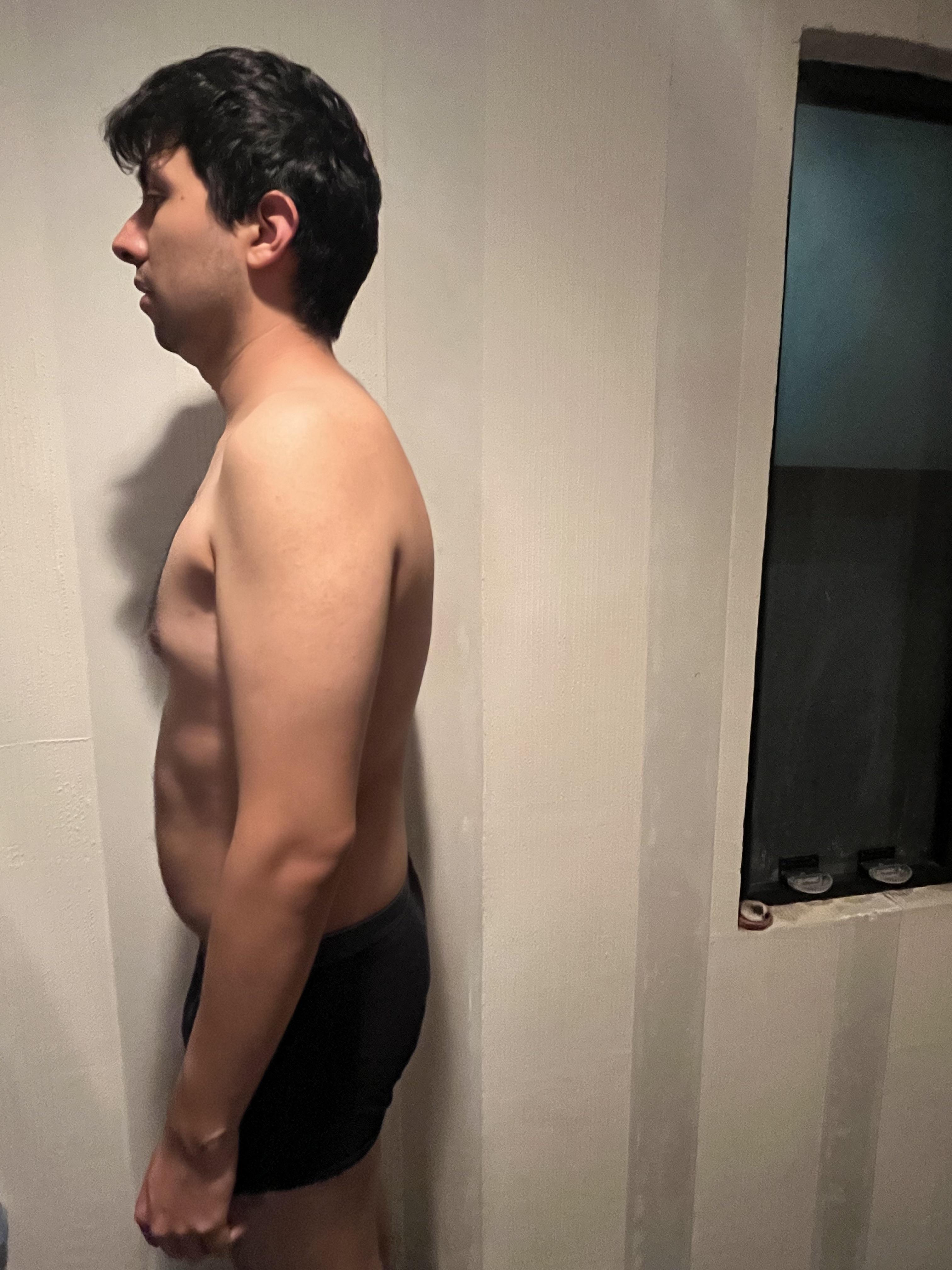 How can i fix my posture? (image + mri)