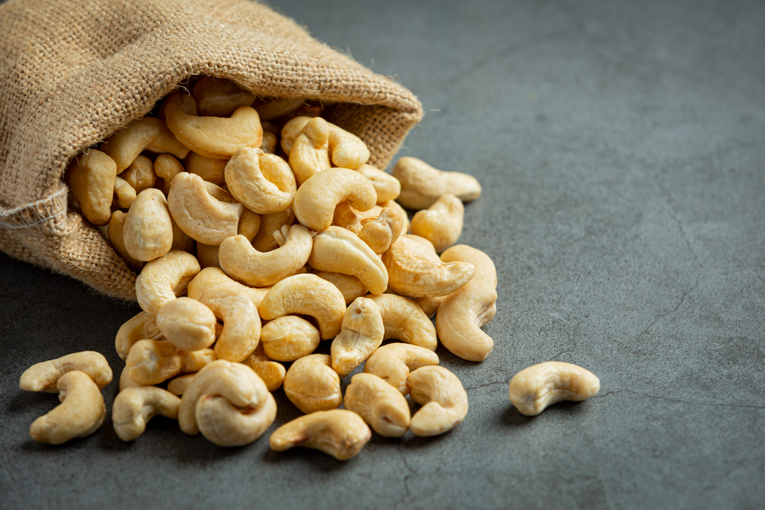 The Health Benefits of Cashew Nuts: Why You Should Make Them a Part of Your Diet Dry Fruits