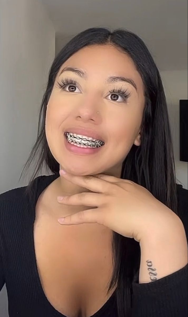 Latina with braces