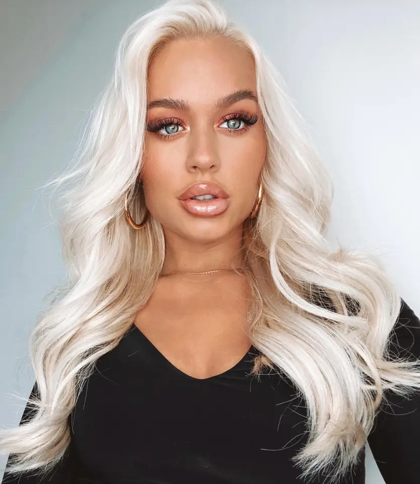 Lottie Tomlinson Says Never Ending Confidence Battle After Losing Mum Led Her To Excessive Fillers Until Face 'blew Up'