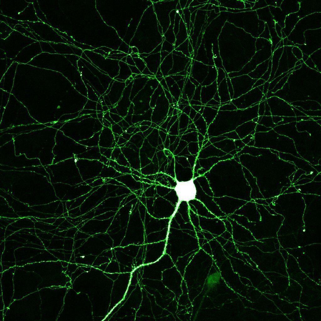 Neuron Implantation Can Rewire Brain Itself