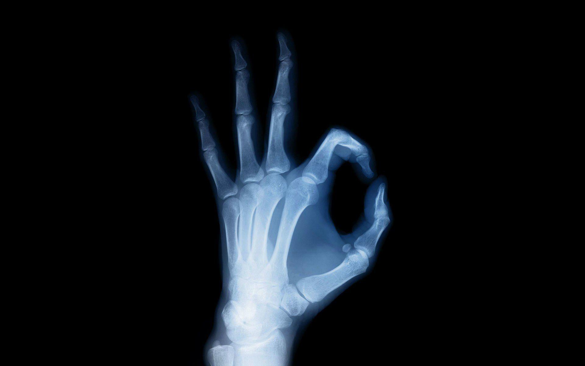Download X Ray Vision Anatomy Hand