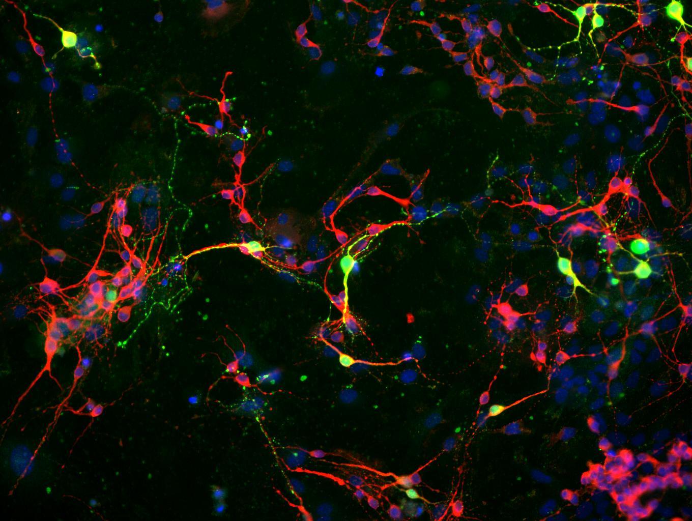 Neurons under a Microscope [1360 x 1024]
