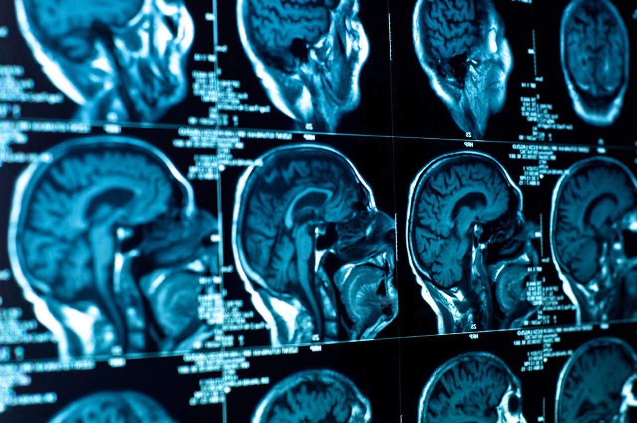 Neuro Medical Wallpaper