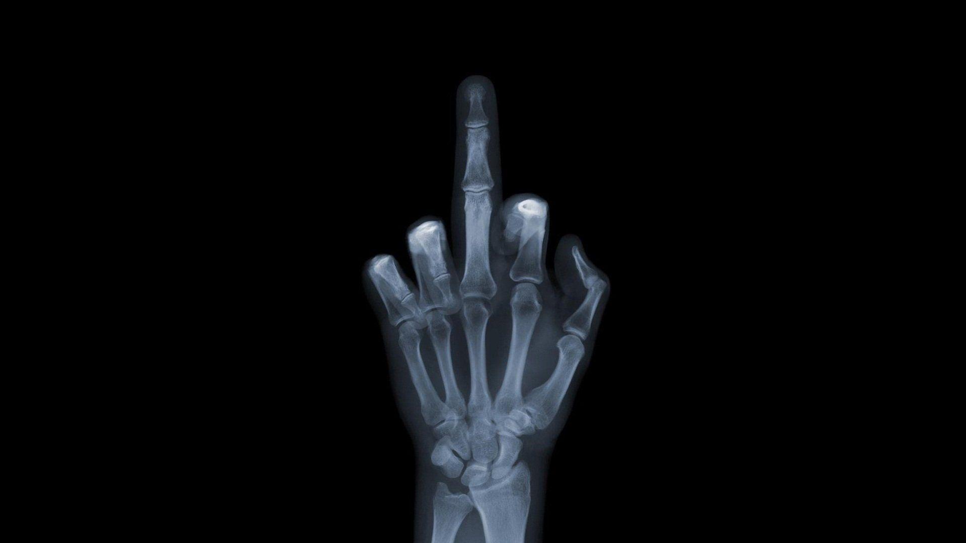 X Rays Hand F*ck You Factor Yu Picture Bone Wallpaper HD Wallpaper