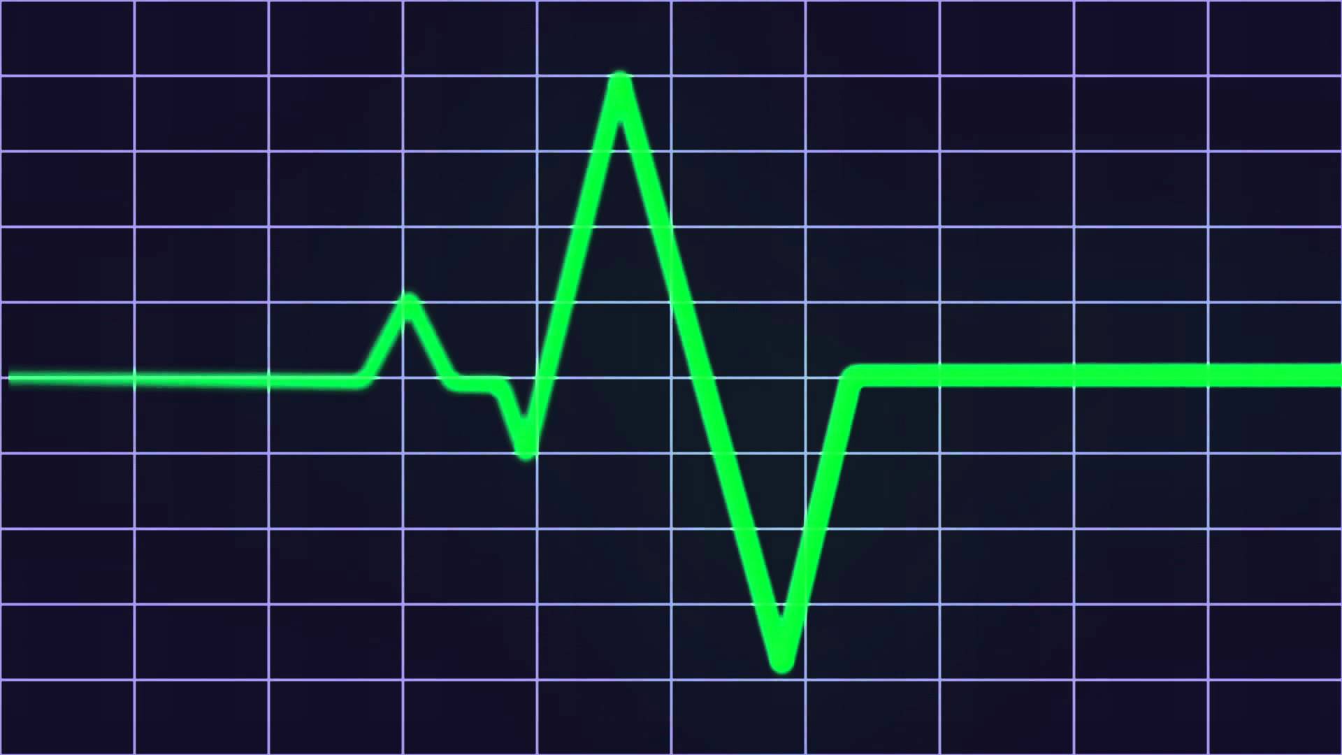 Heart beat monitor HD