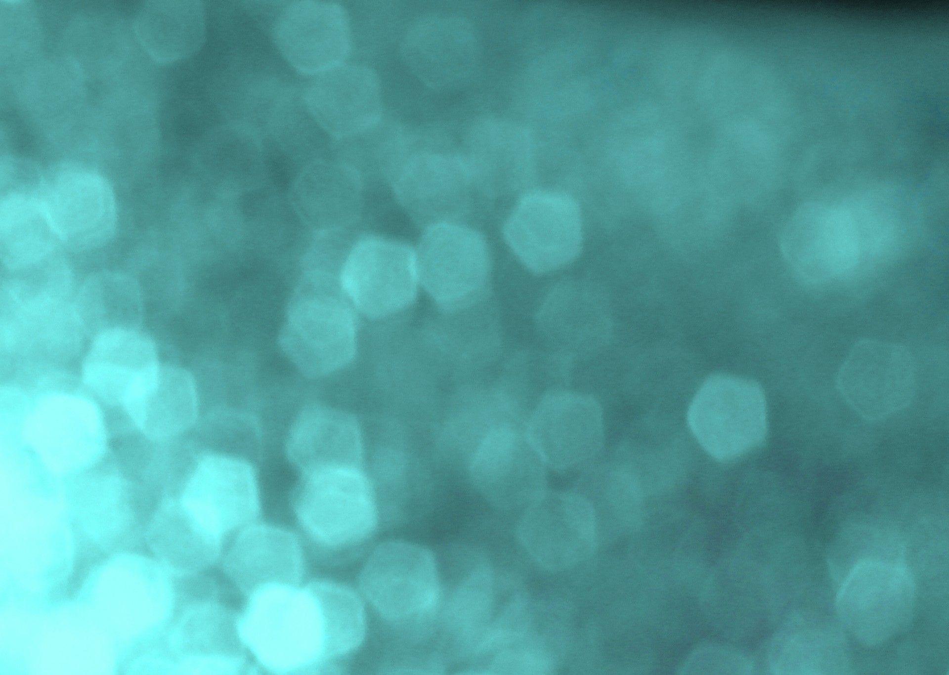 Abstract Bokeh Light Background Free Domain