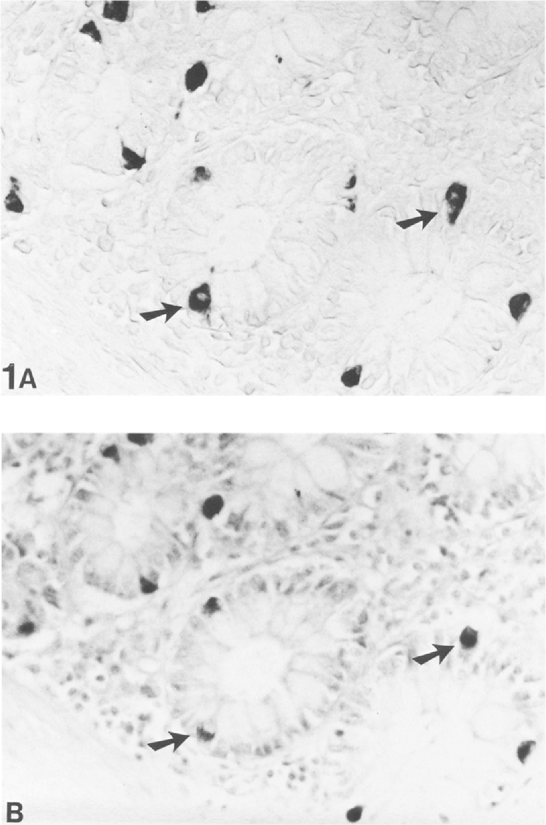 Silver stains for identification of neuroendocrine cells. A study