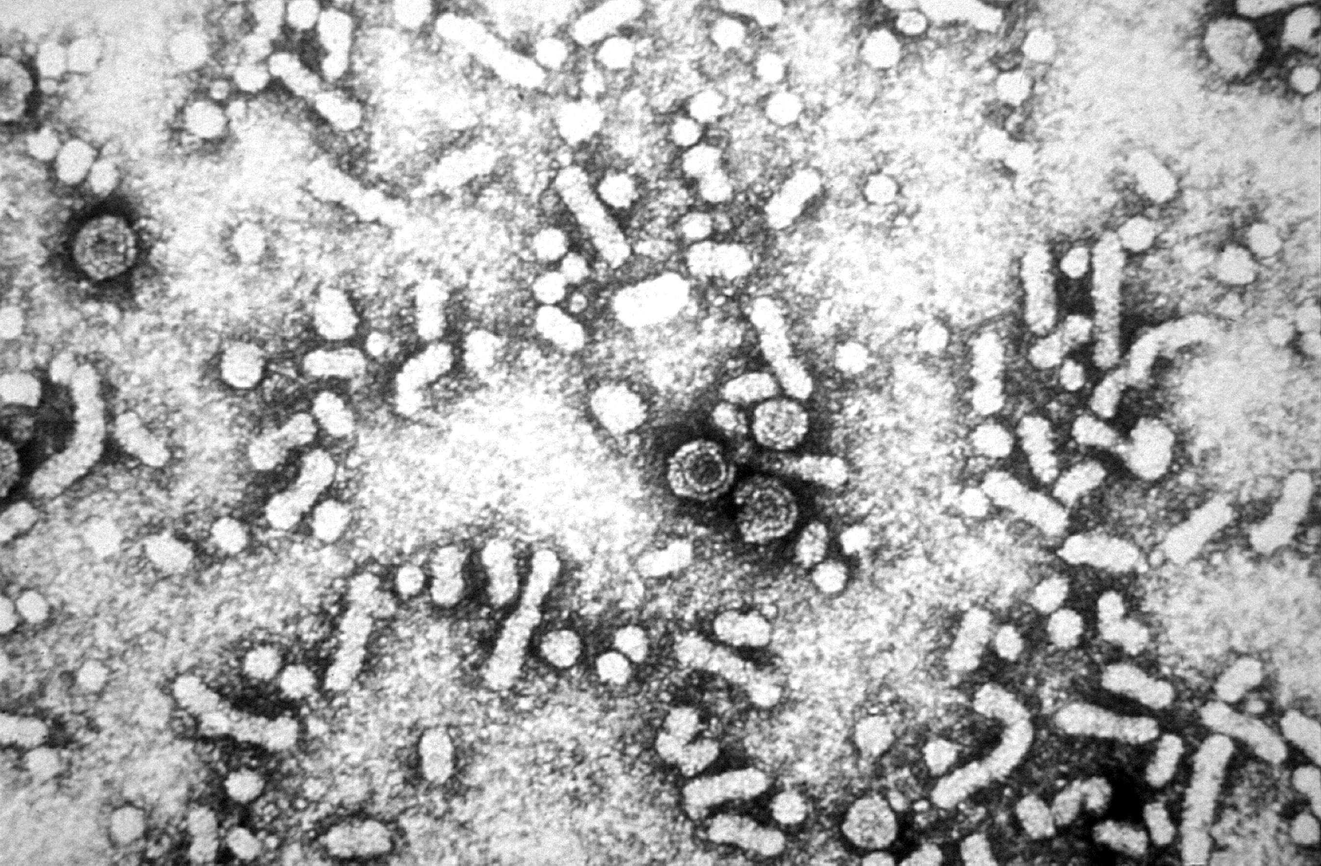 Free picture: electron micrograph, presence, hepatitis, virus, dane