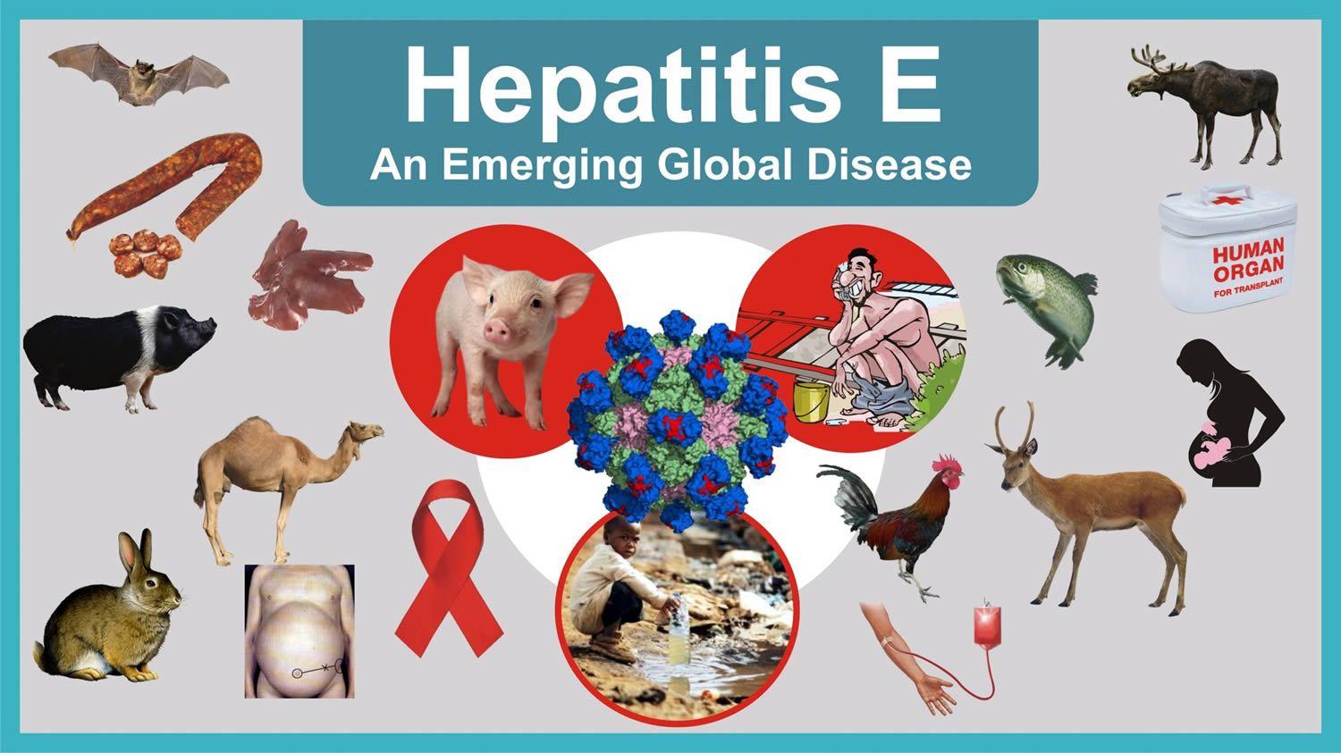 Hepatitis Clipart