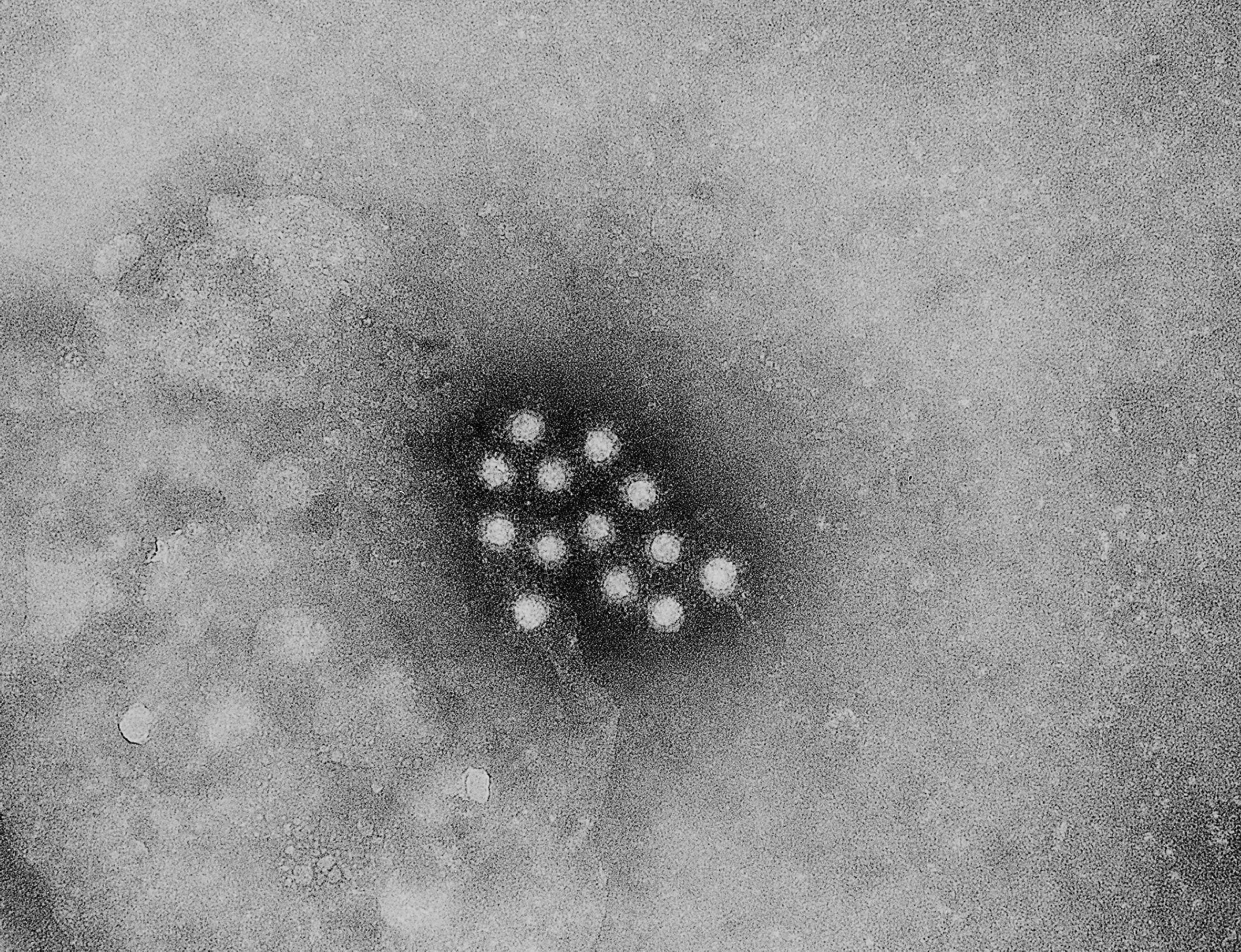 Free picture: hepatitis, virus, virus, survive, month, room, temperature