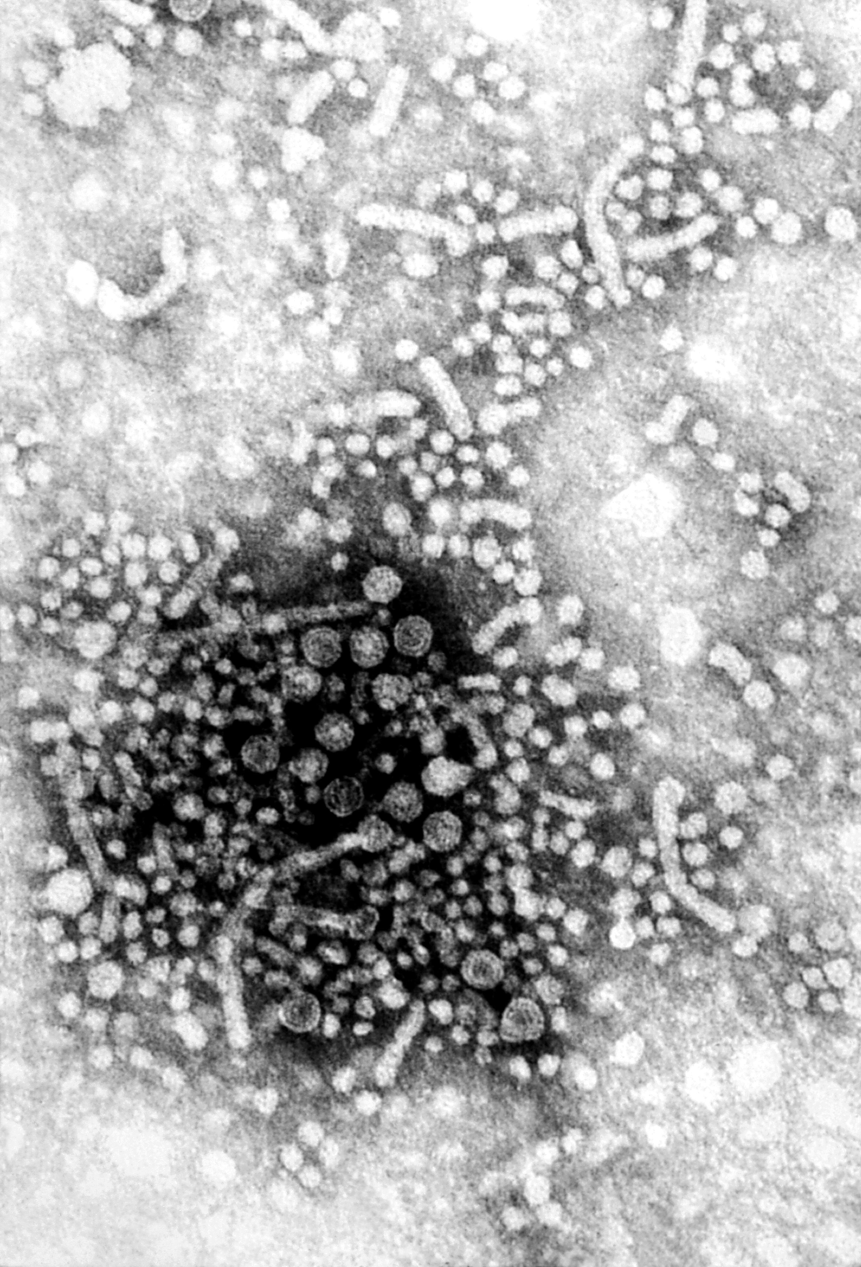 Free picture: hepatitis, virus, virions, know, dane, particles