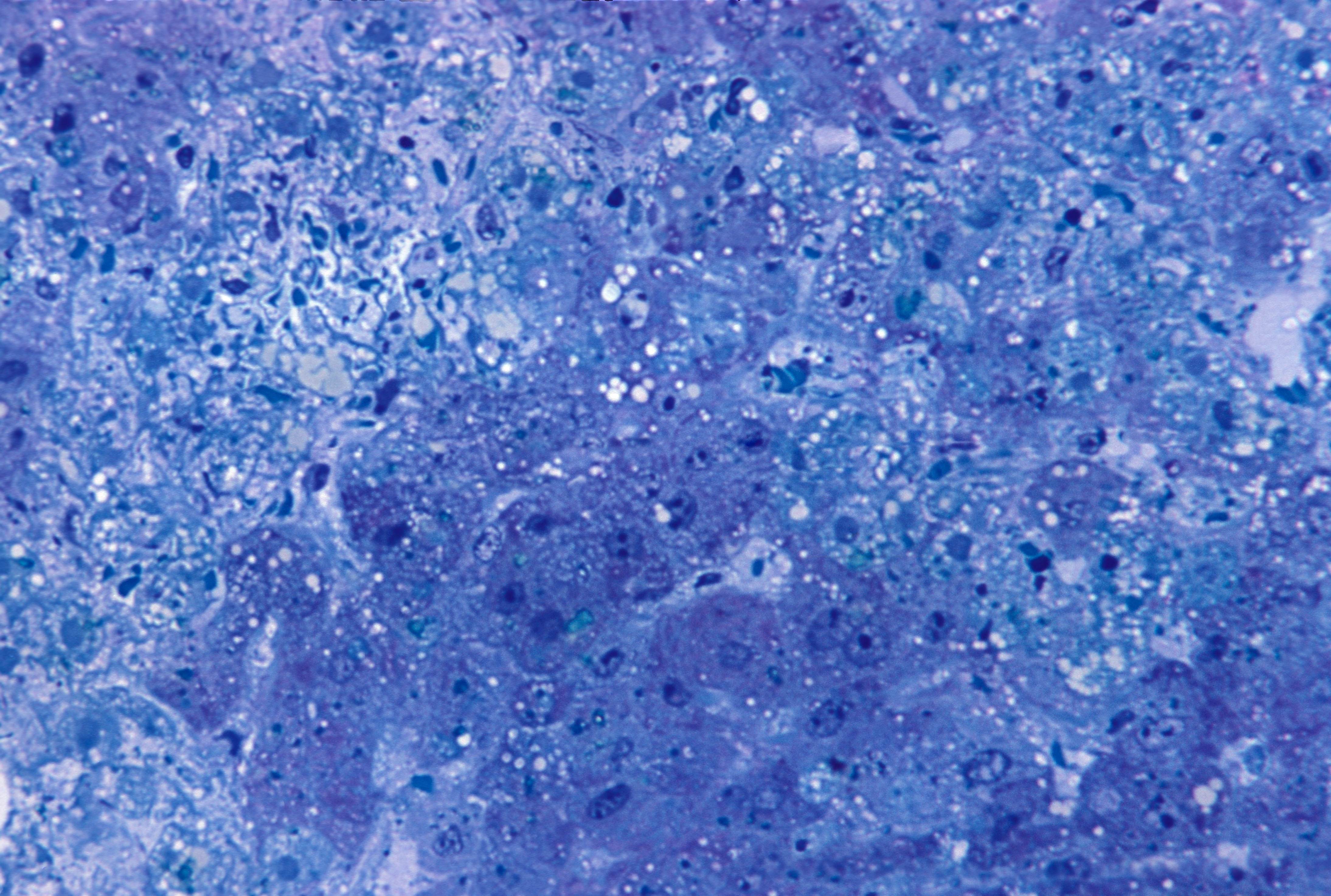 Free picture: micrograph, hepatitis, lassa, virus