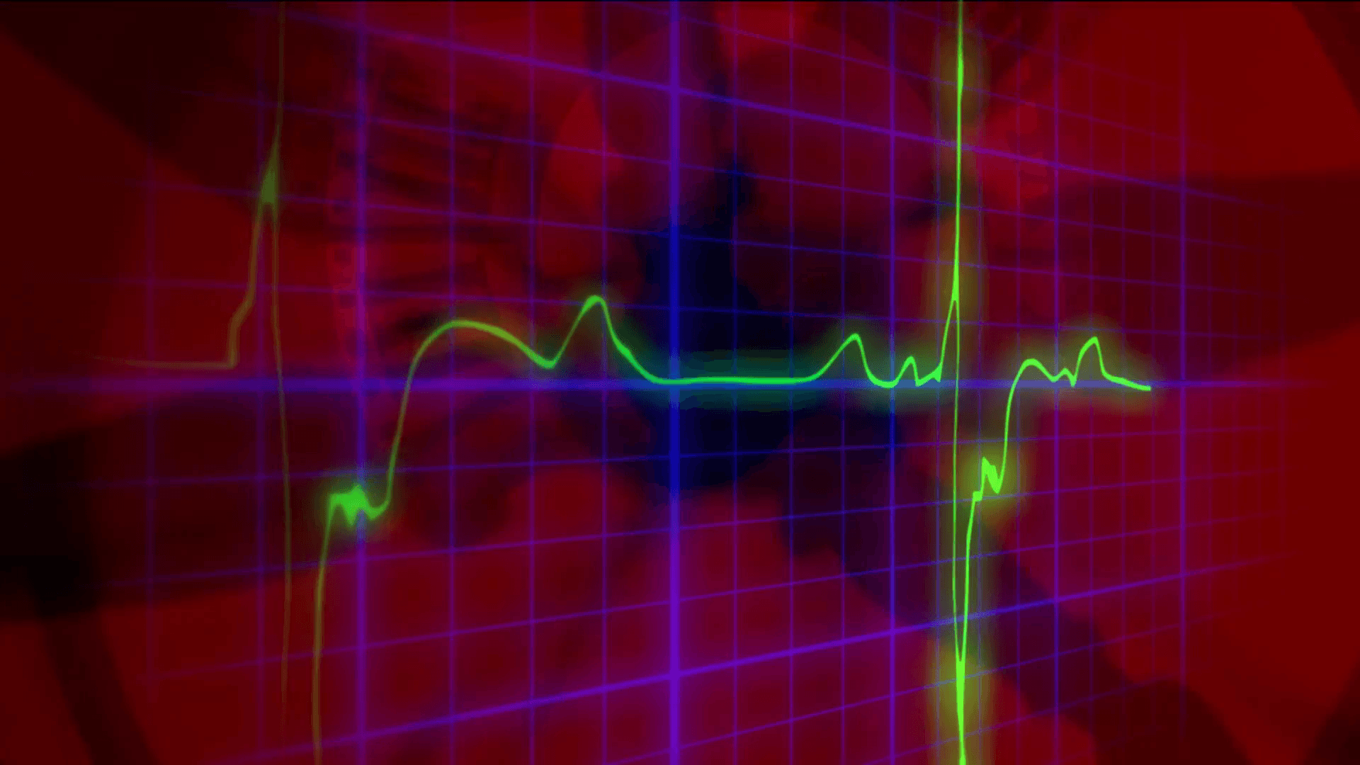 EKG heartbeat 3D crazy clocks. Red silhouettes of clocks going