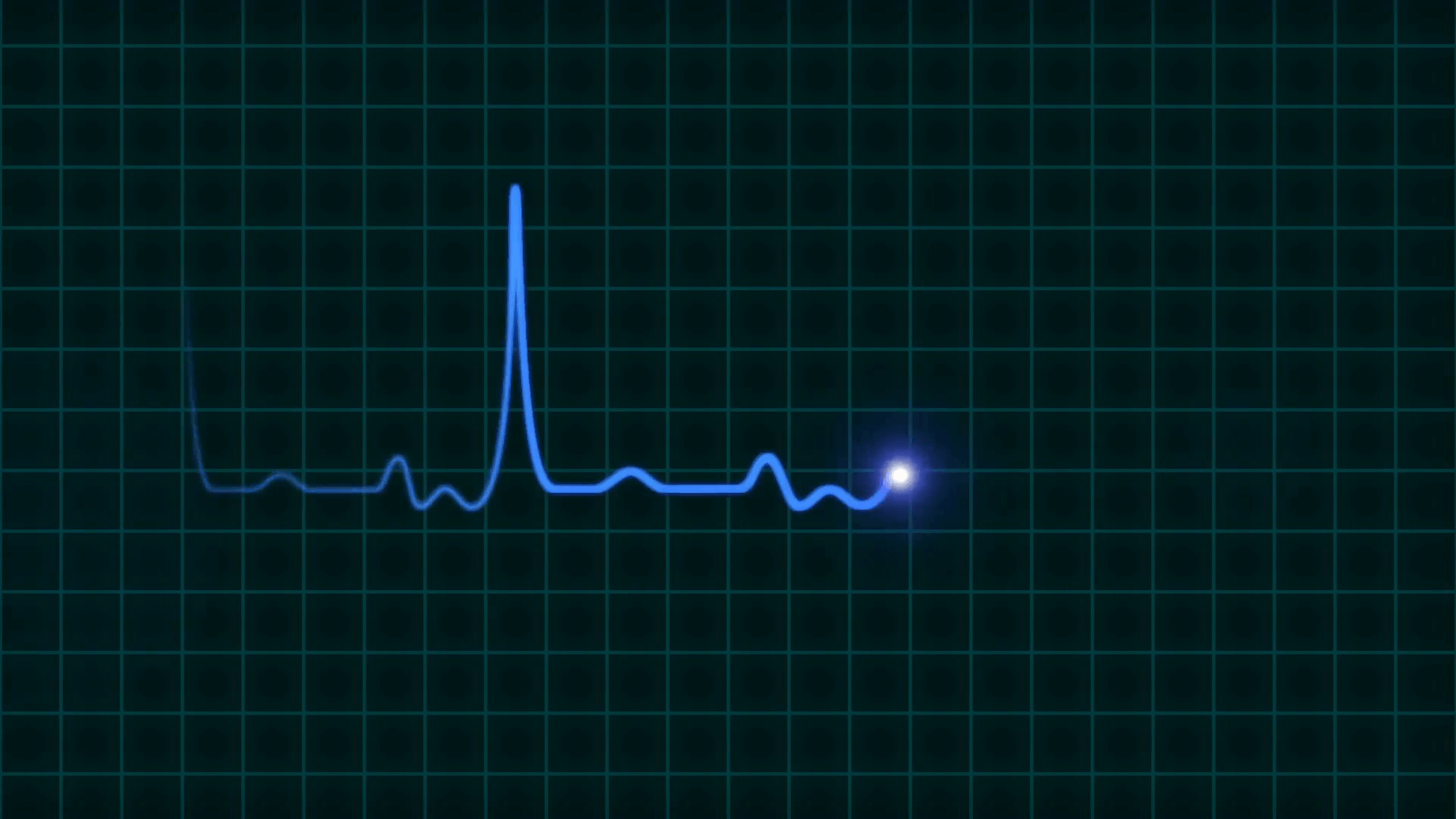 An animated EKG heartbeat monitor in blue wave line one beat
