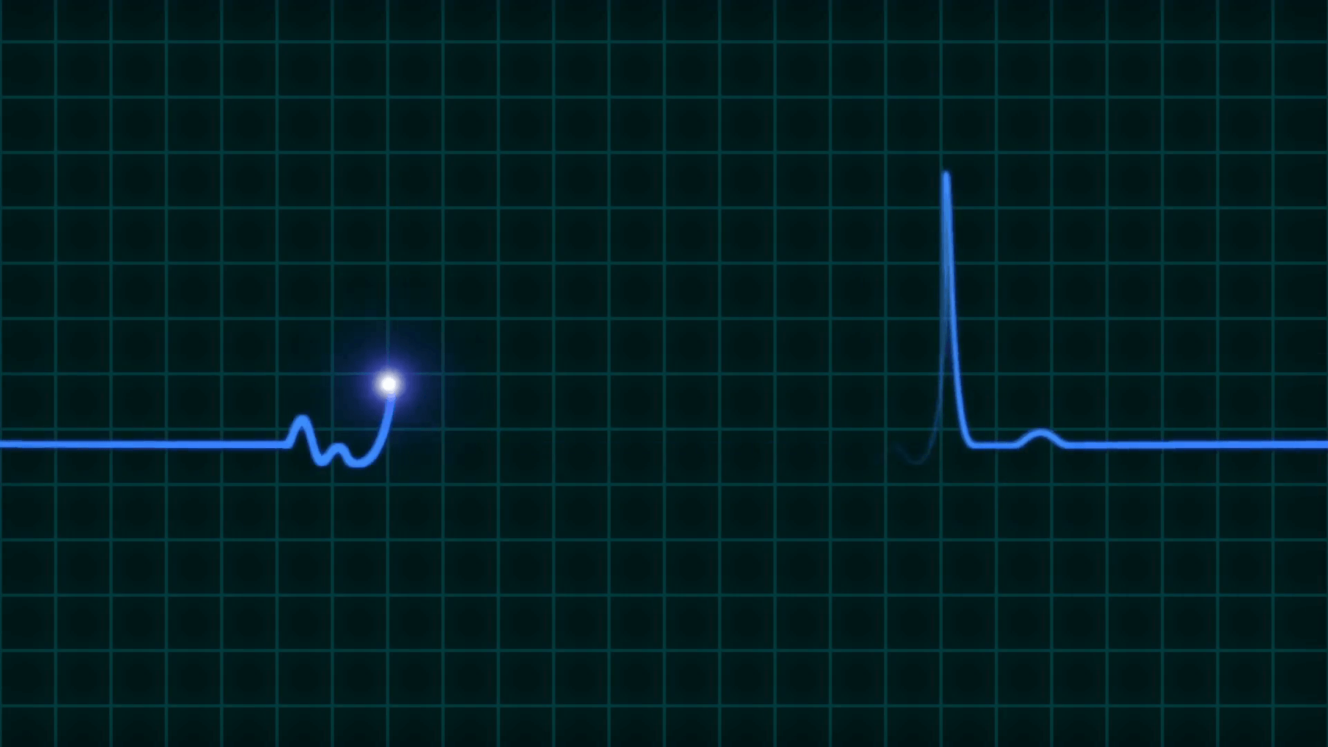 An animated EKG heartbeat monitor in blue wave line four beat