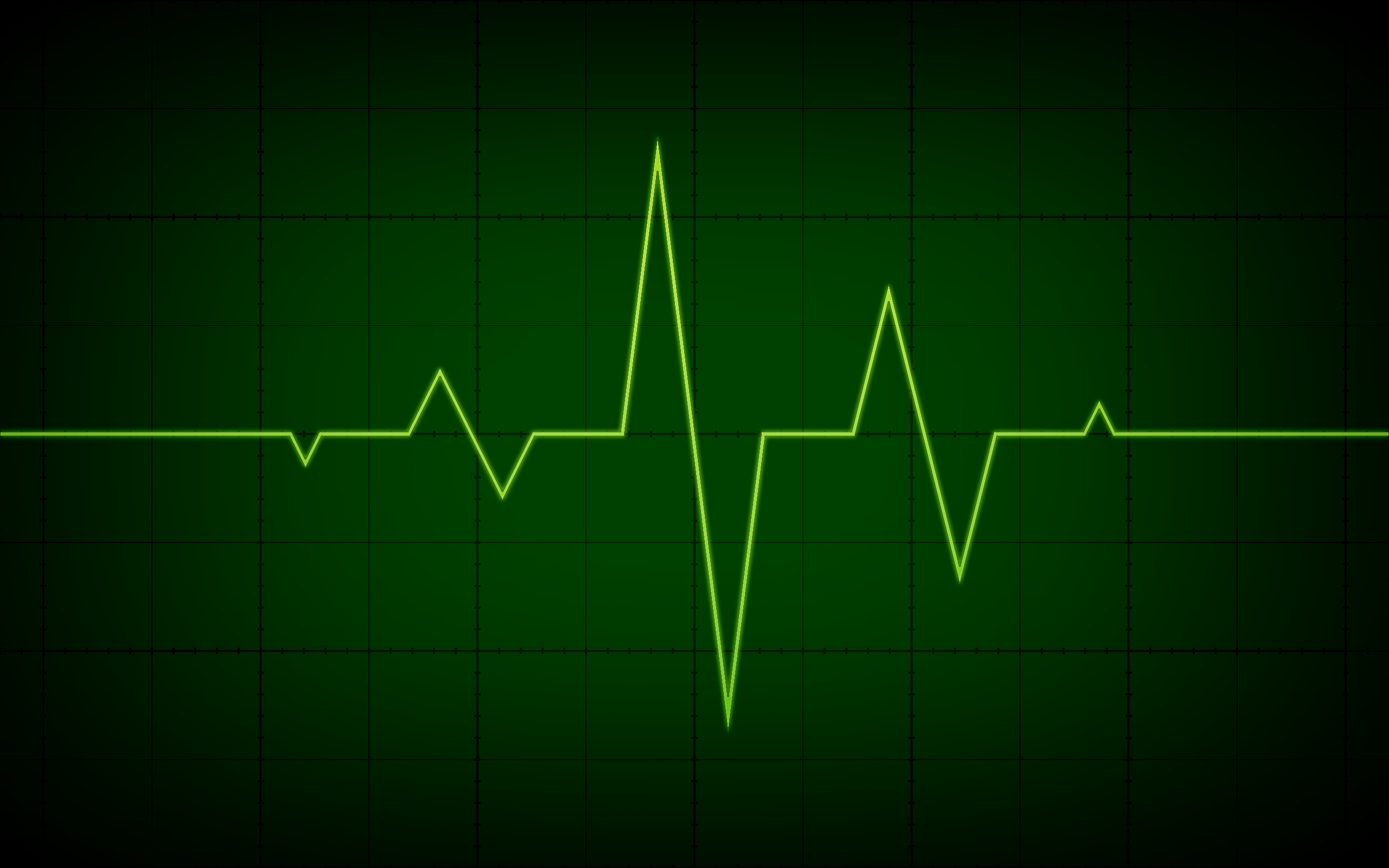 cardiograph app shows irregular heartbeat