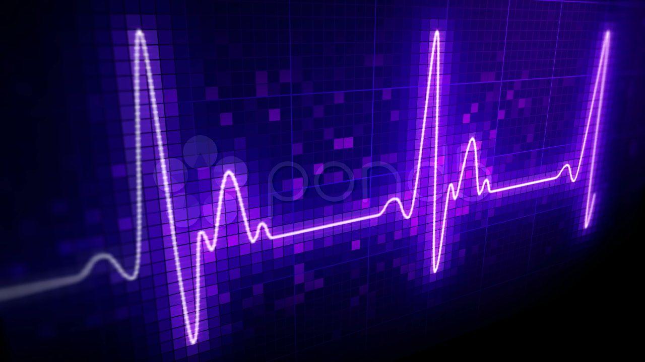Video: Seamlessly looping EKG heart monitor. HD progressive