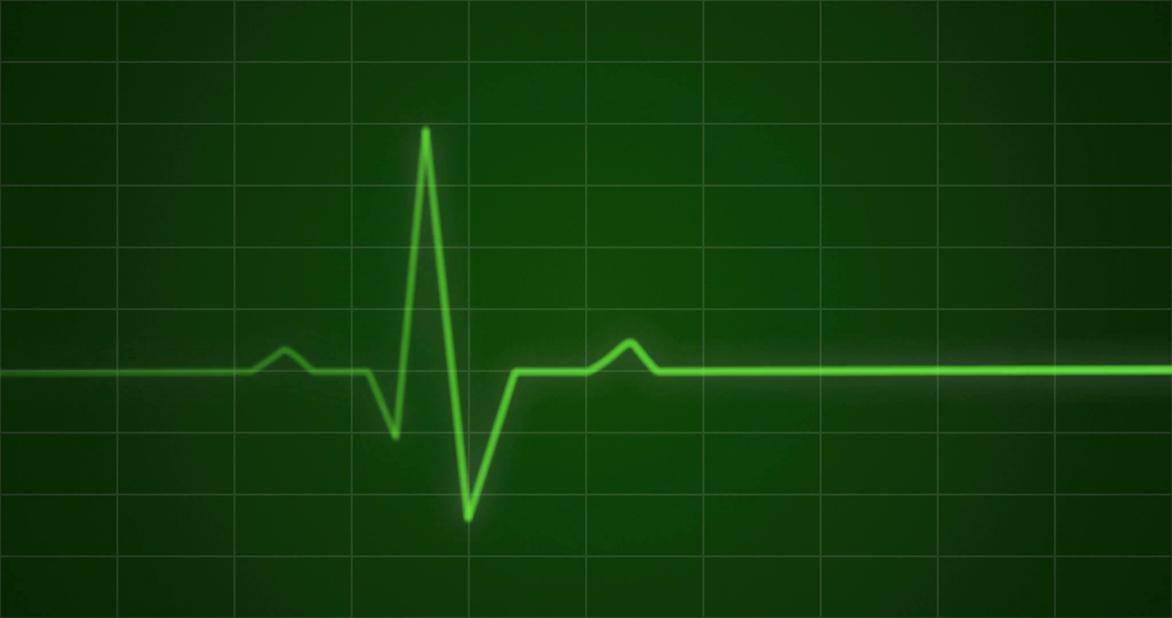 EKG heartbeat monitor, animation Motion Background