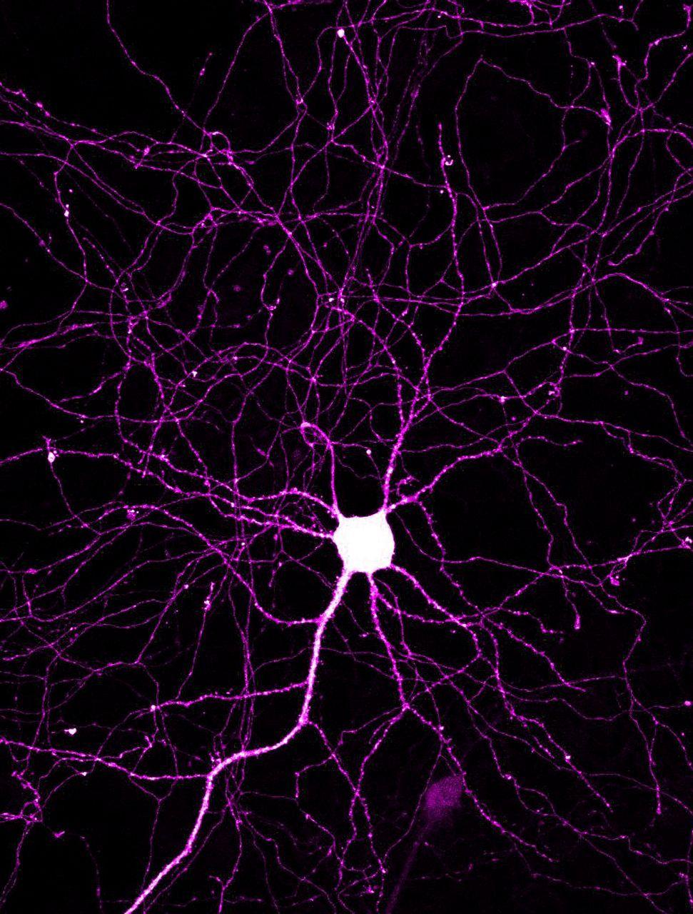 The axons and dendrites of a cortical neuron. Anatomy & Physiology