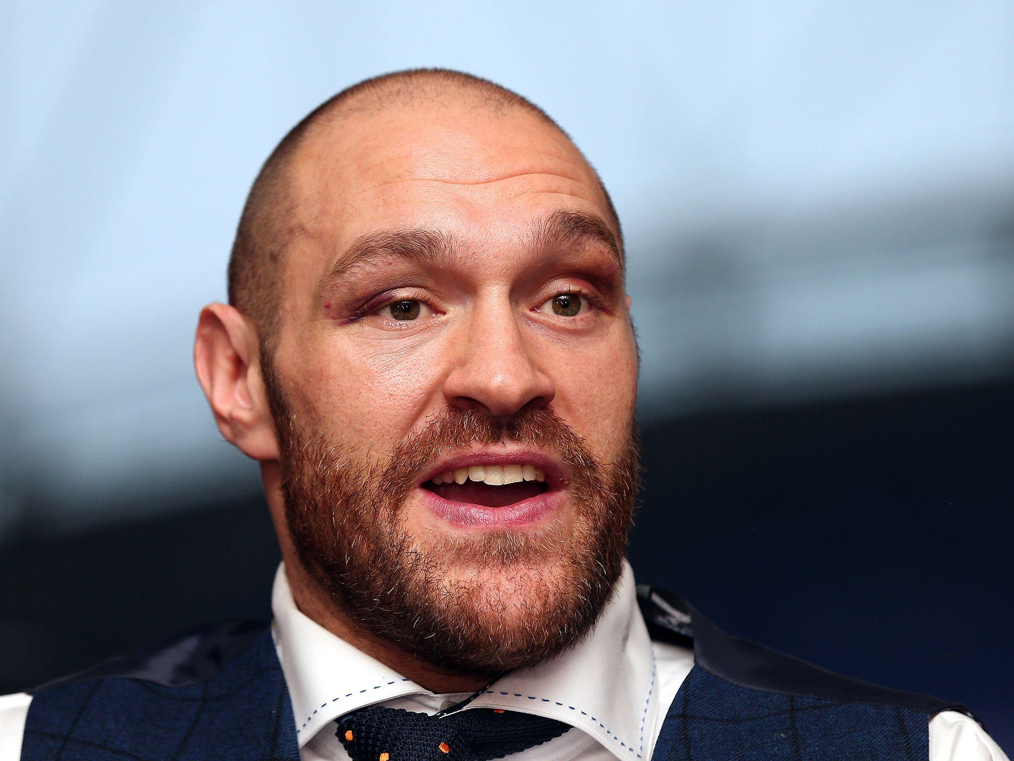 Anthony Joshua will face Tyson Fury under two conditions