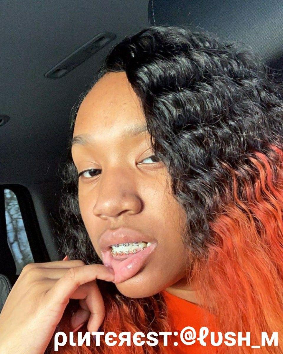 Hair styles. Brace face, Braces, Long