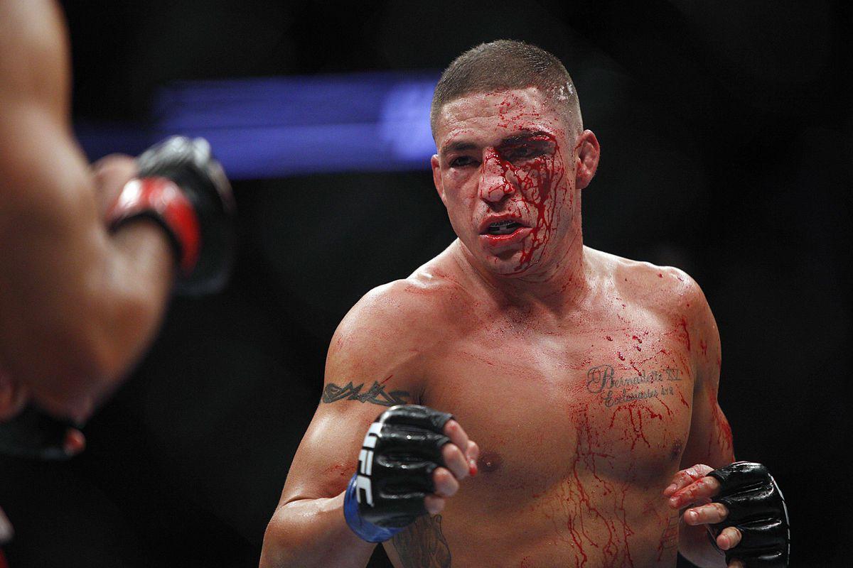 Pic: UFC lightweight Diego Sanchez has nasty hole and hardware