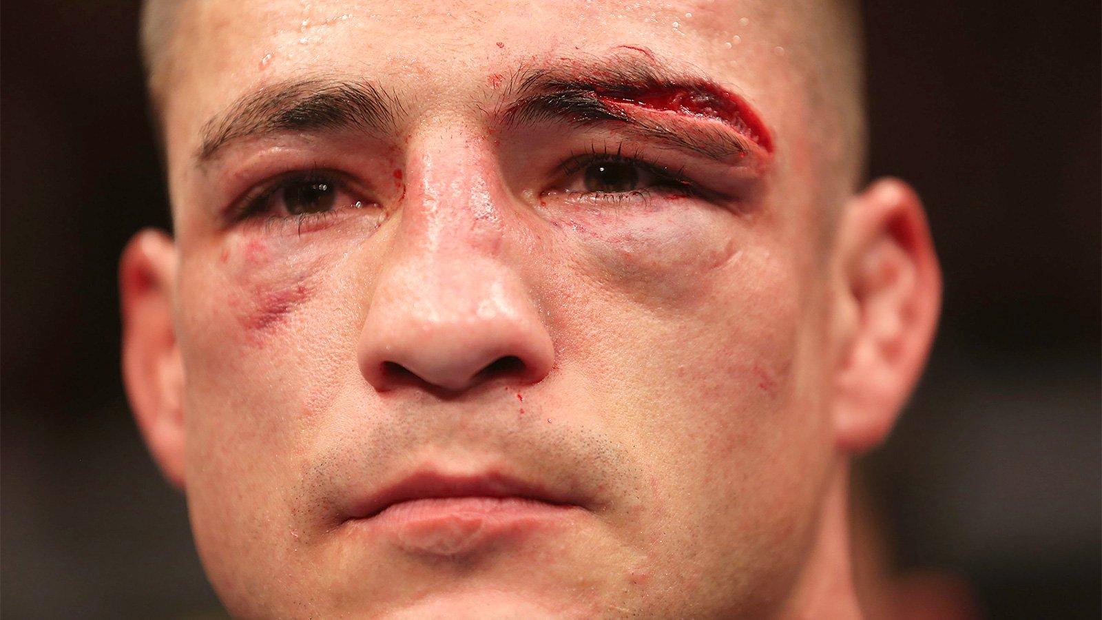 Diego Sanchez Tears Into Cowboy Cerrone Amidst Gym Departure