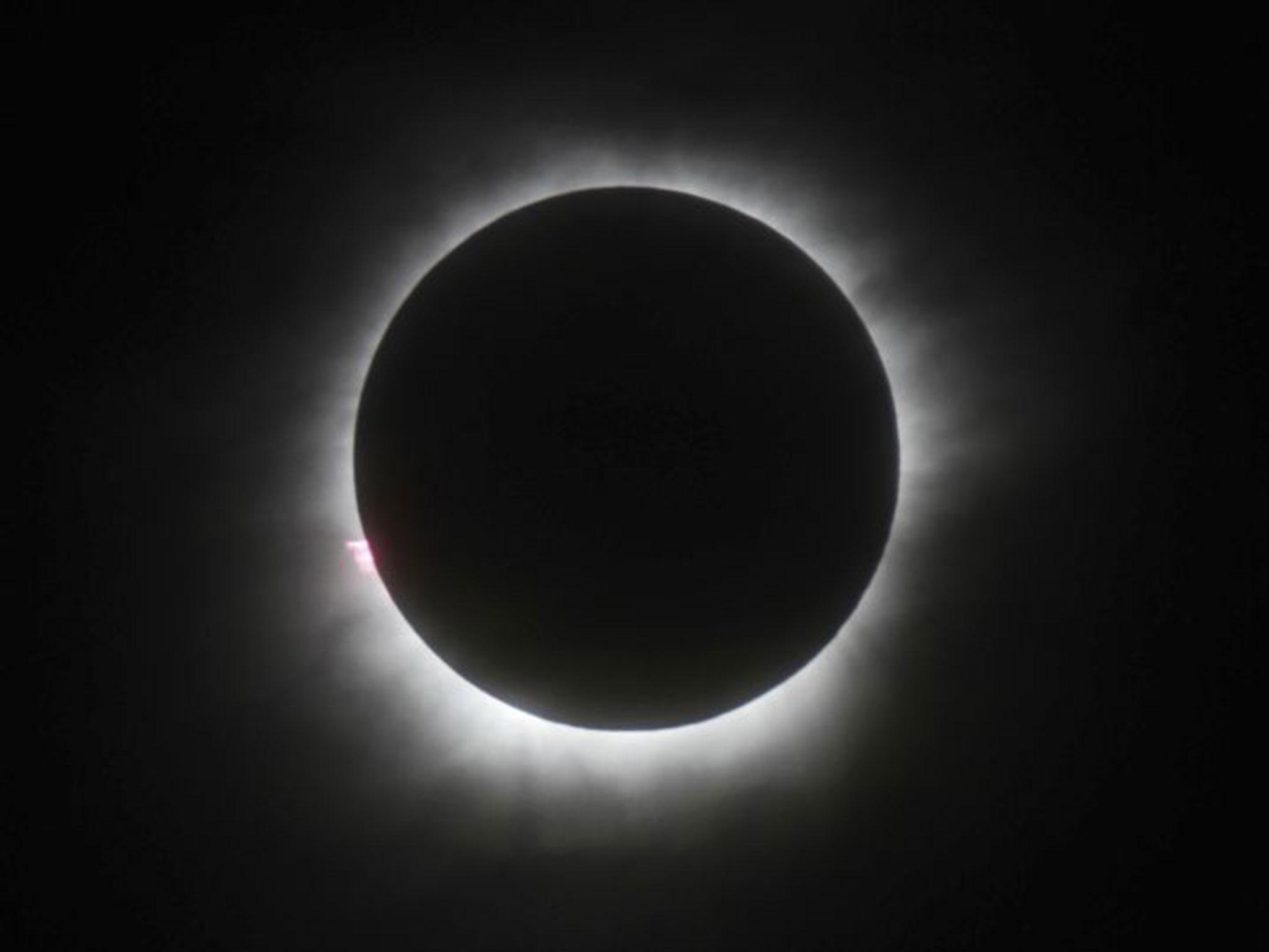 Eclipse 2017: Man who permanently damaged his eyes during a solar
