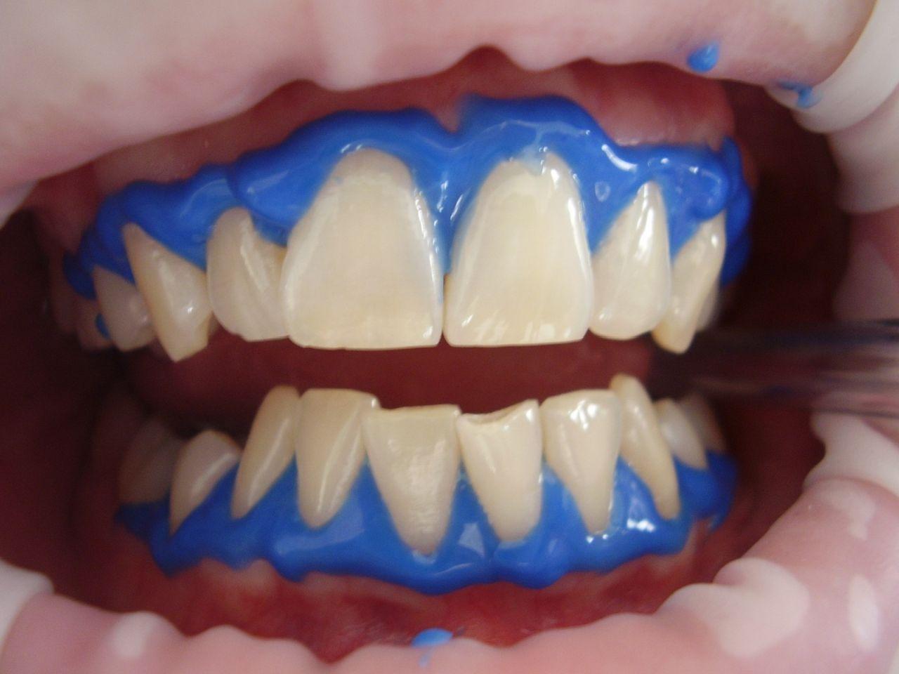 Dental Smile Image Full HD or Free Download