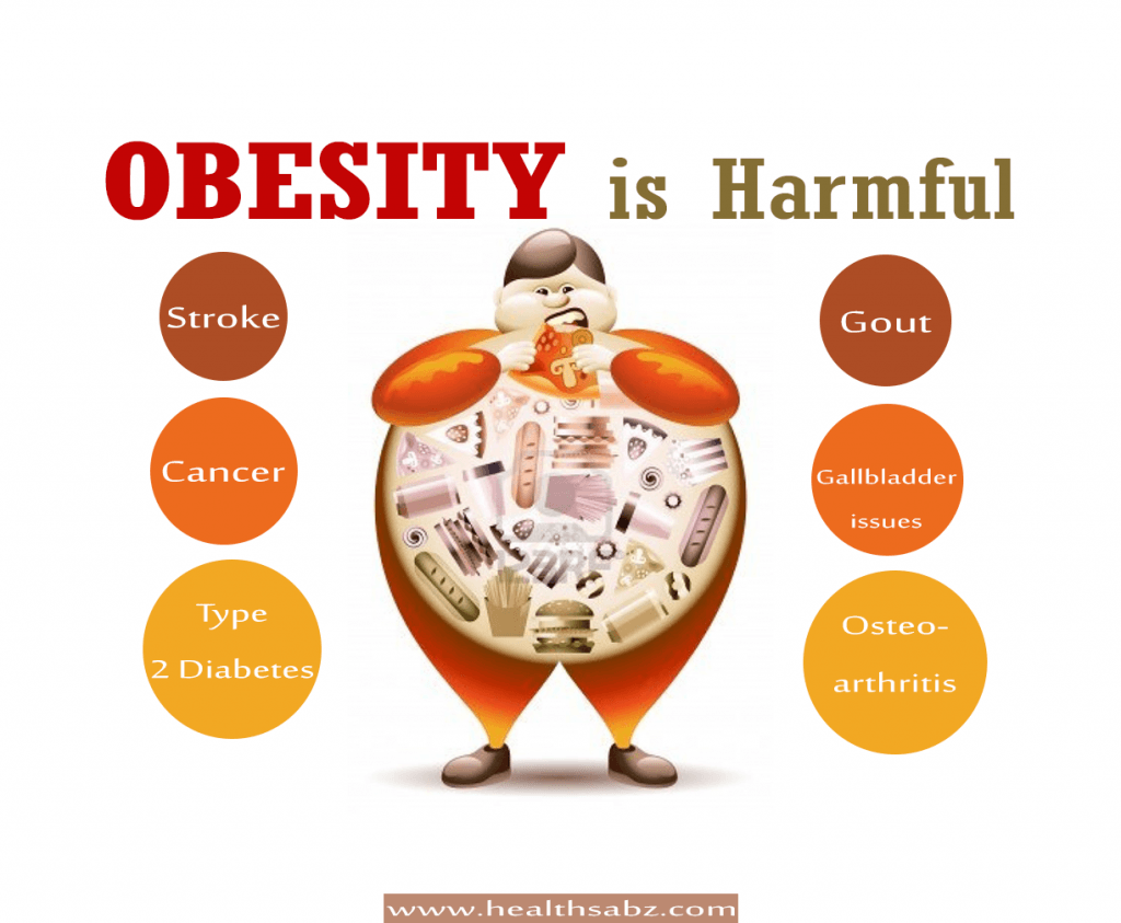 Obesity (image in Collection)
