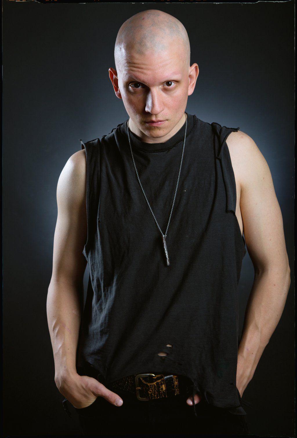 Anthony Carrigan (aka Victor Zsasz) from Gotham. Anthony