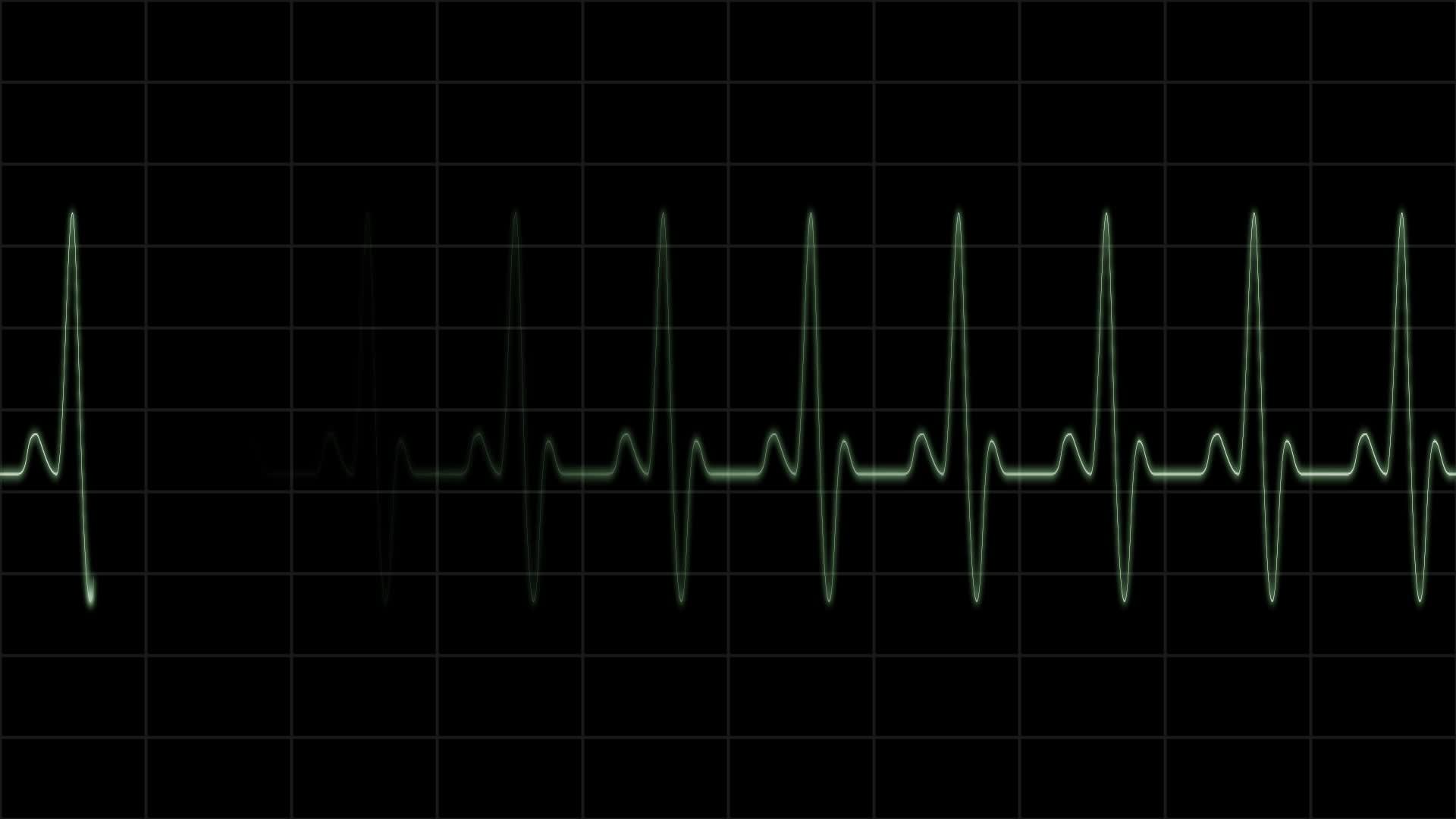 A Complete Guide to Echocardiogram Interpretations | Specialist Direct