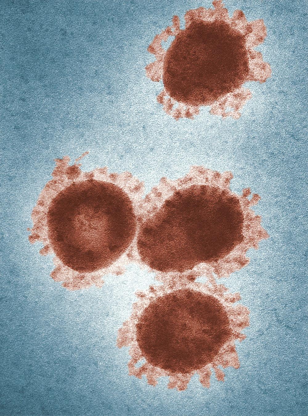 Coronavirus Picture. Download Free Image