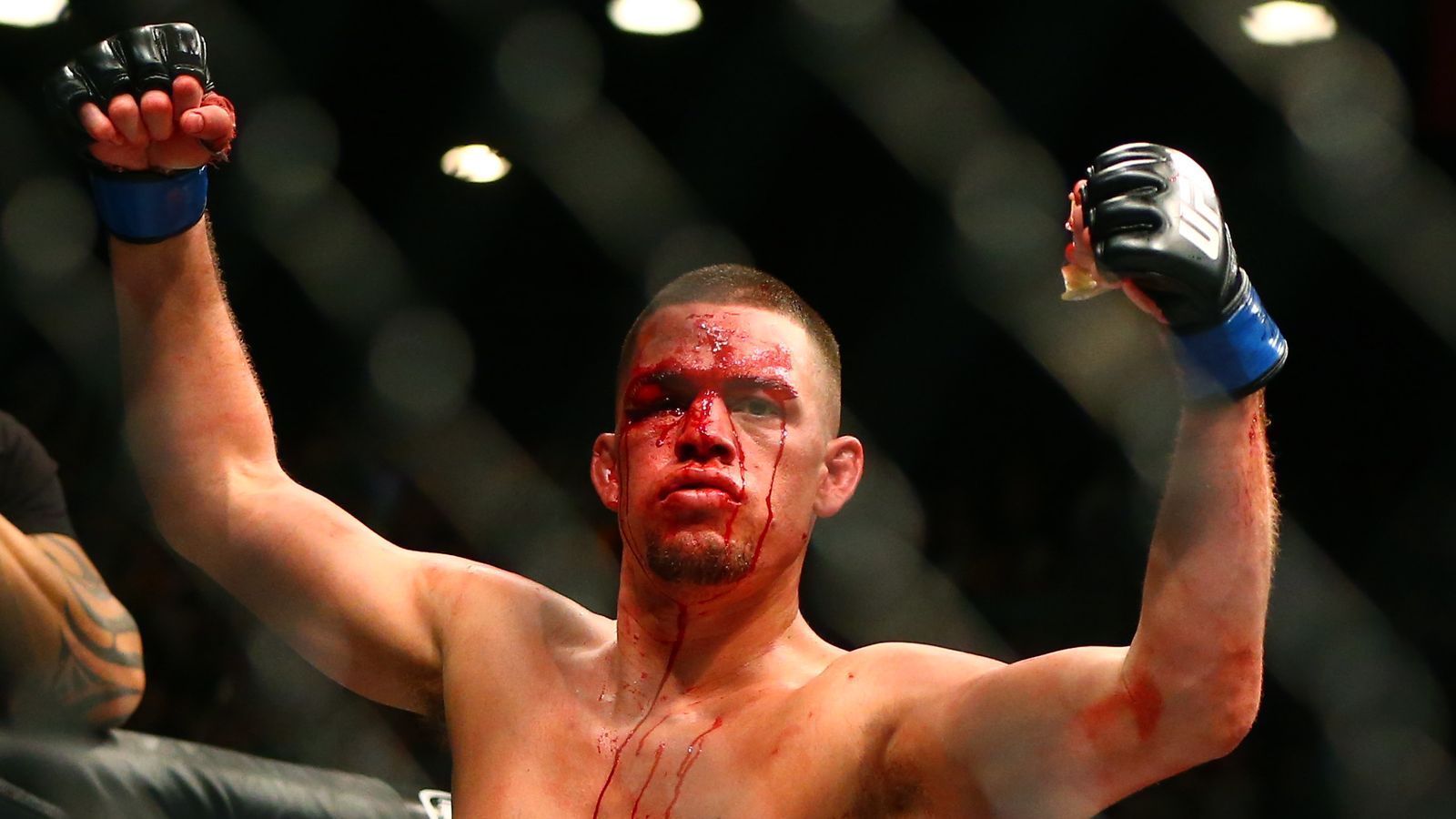 Nate Diaz Anthony Pettis Cut