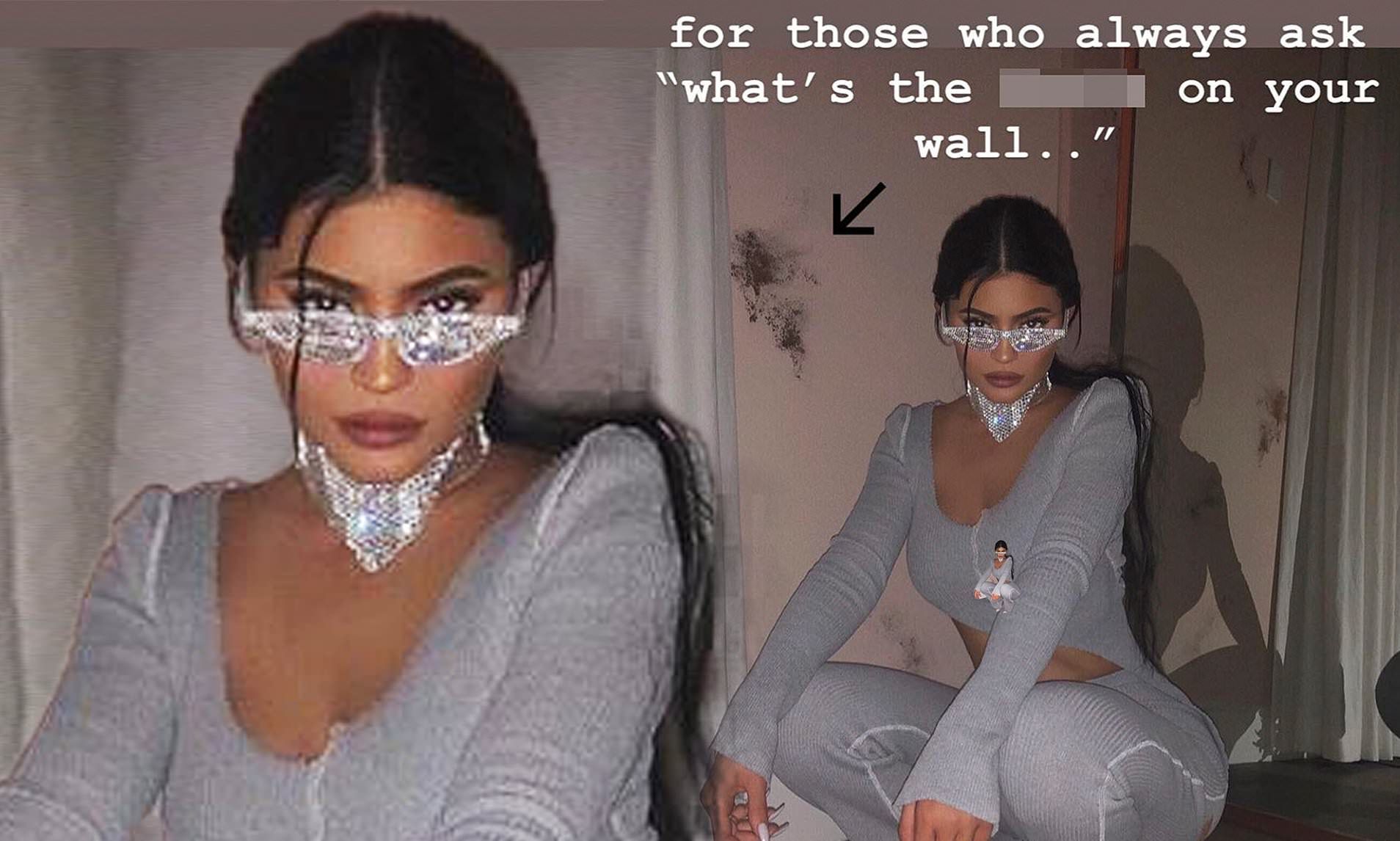 Kylie Jenner FINALLY explains the unusual dark splotches on her