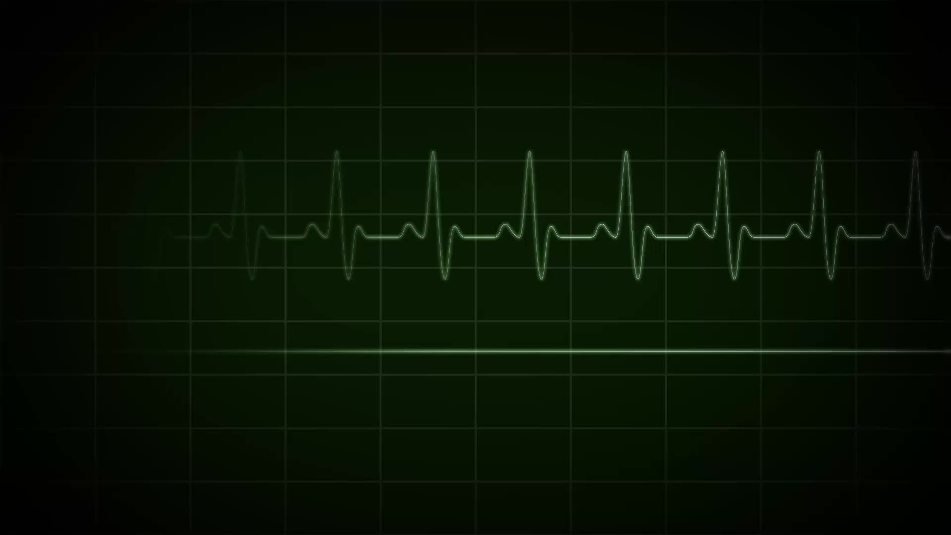 EKG Wallpaper. EKG Wallpaper, EKG