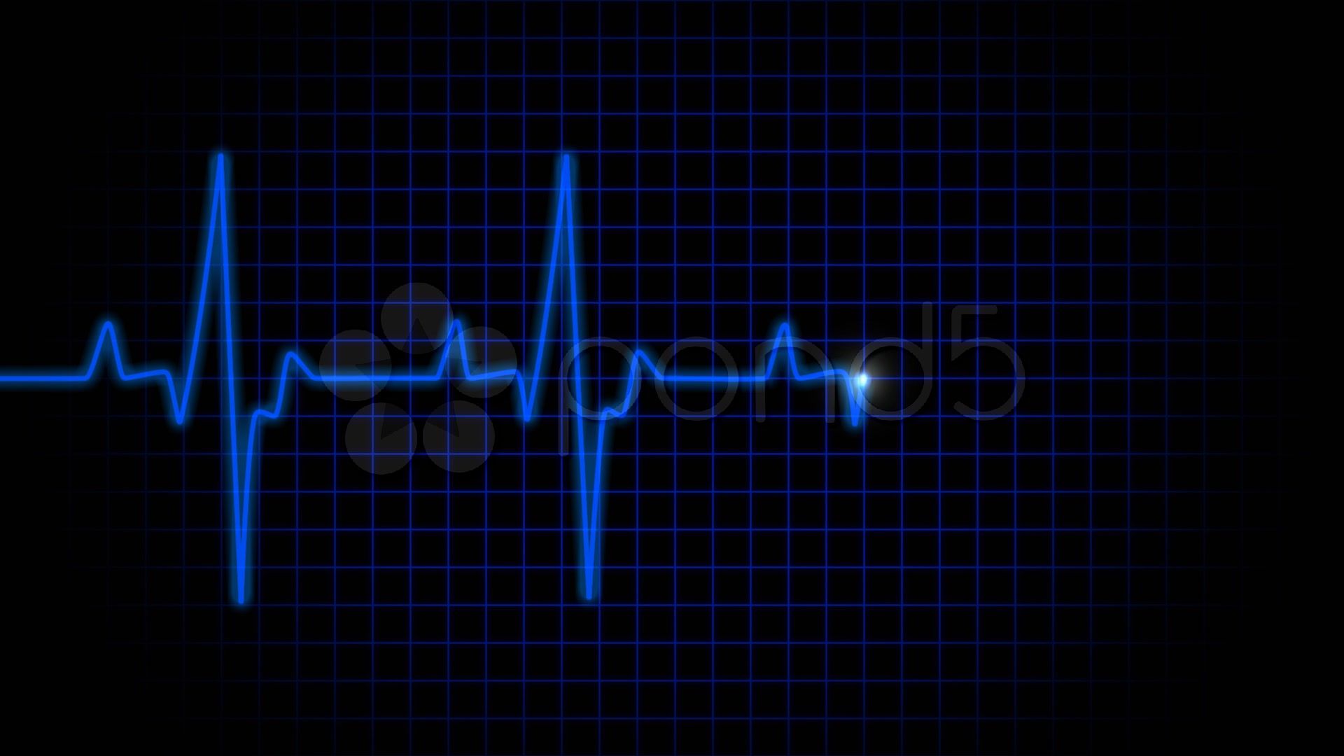 100+ Free Ecg & Heartbeat Images - Pixabay