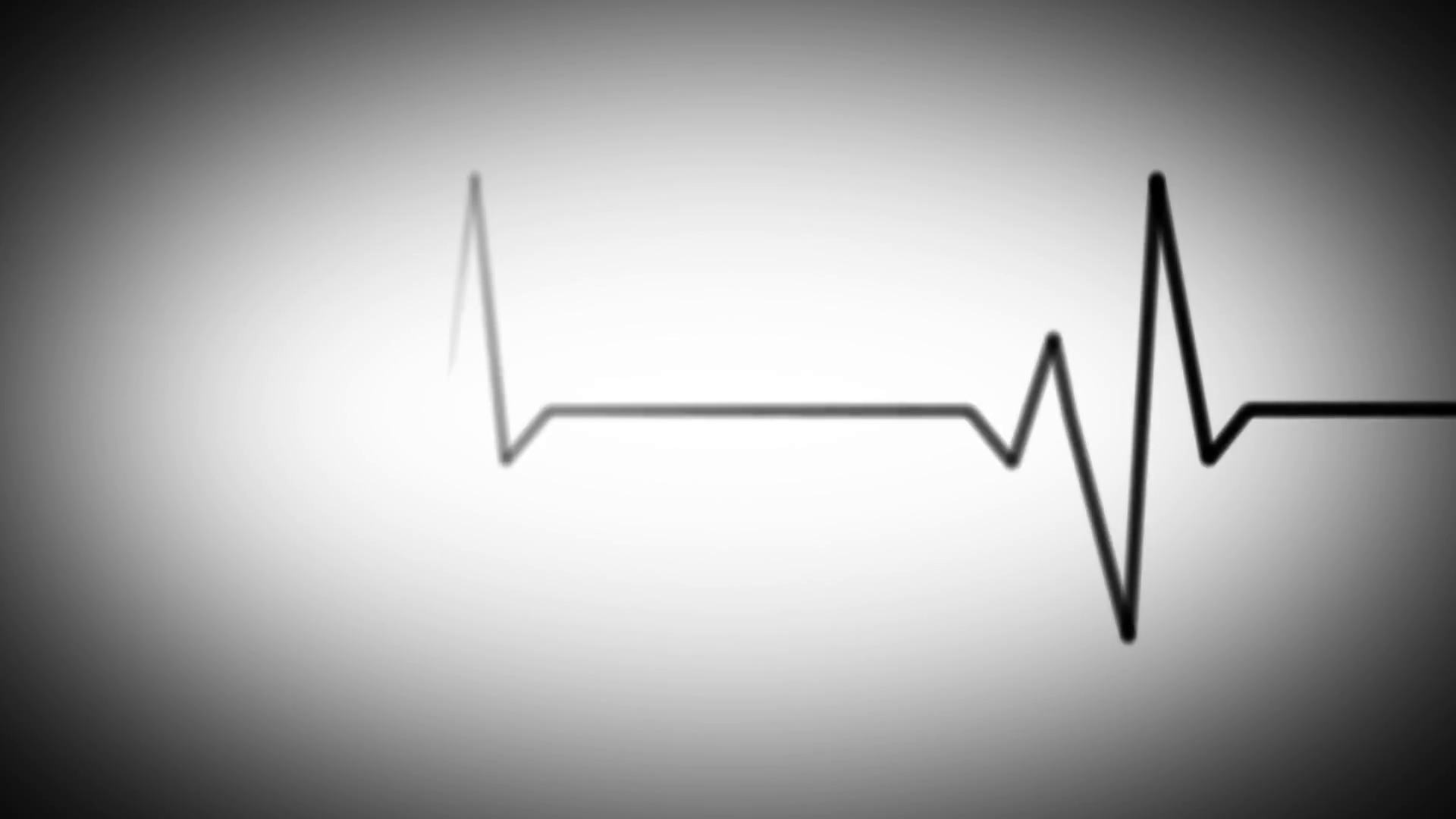 Electrocardiogram Black And White Motion Background