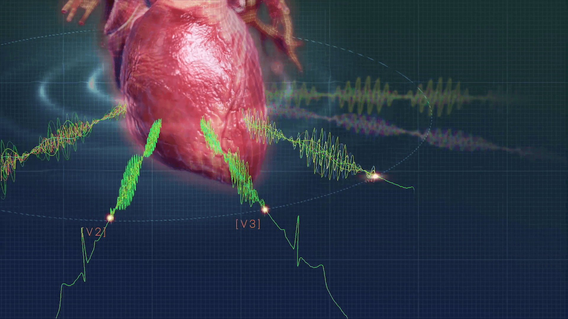 Heart Sciences MyoVista Wavelet ECG Technology Animation