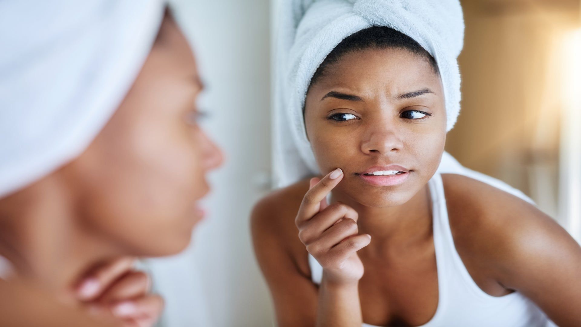 Cystic Acne Treatments For Darker Complexions