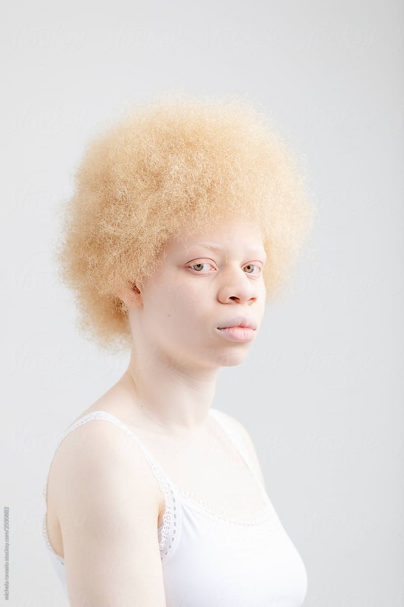 Portrait of an albino girl