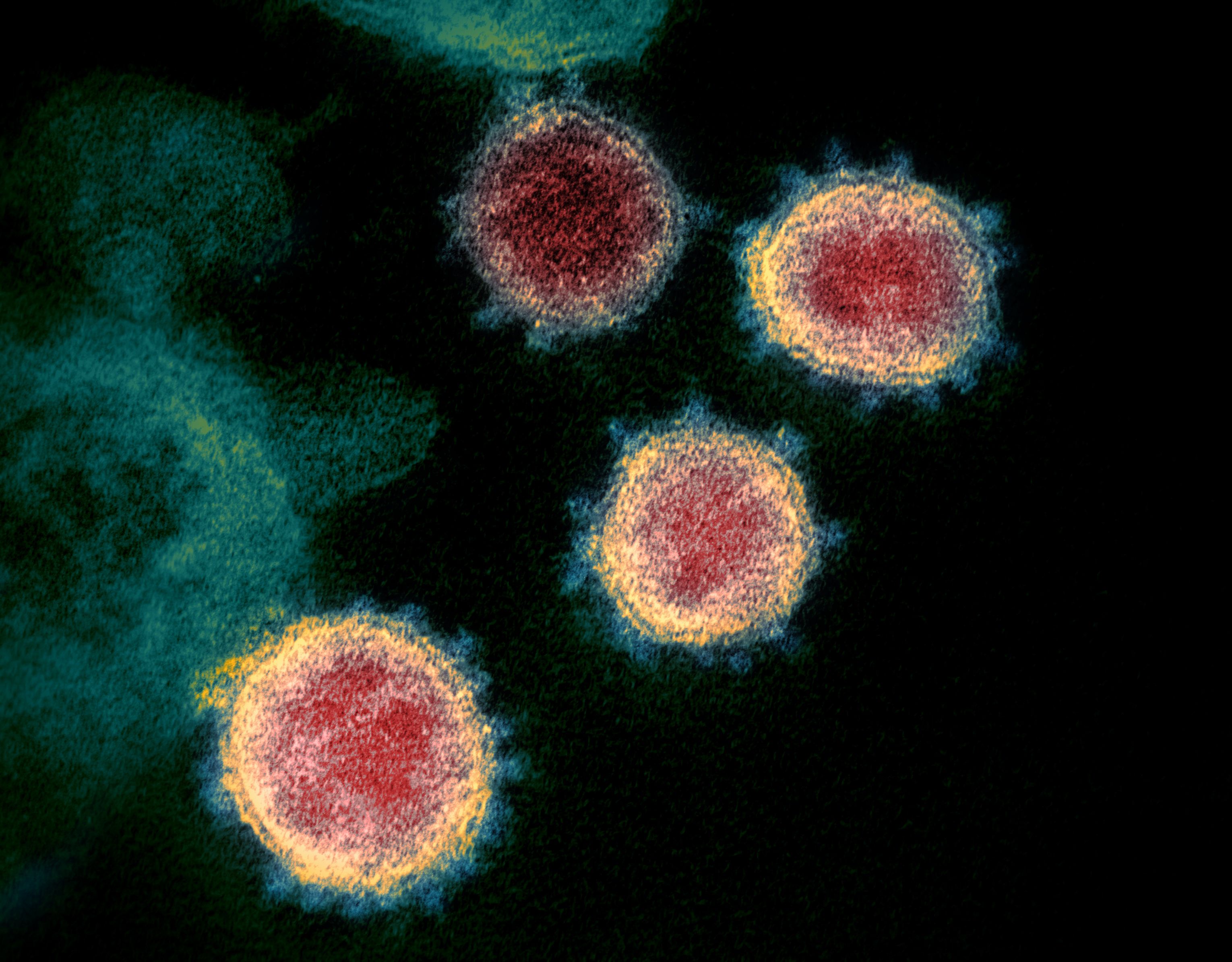 Image of the Day: Coronavirus Under the Scope. The Scientist Magazine®