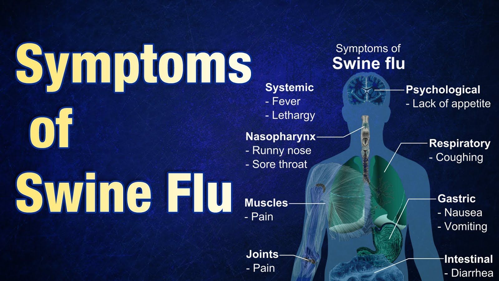 H1N1 “swine flu” virus outbreak in Ethiopia