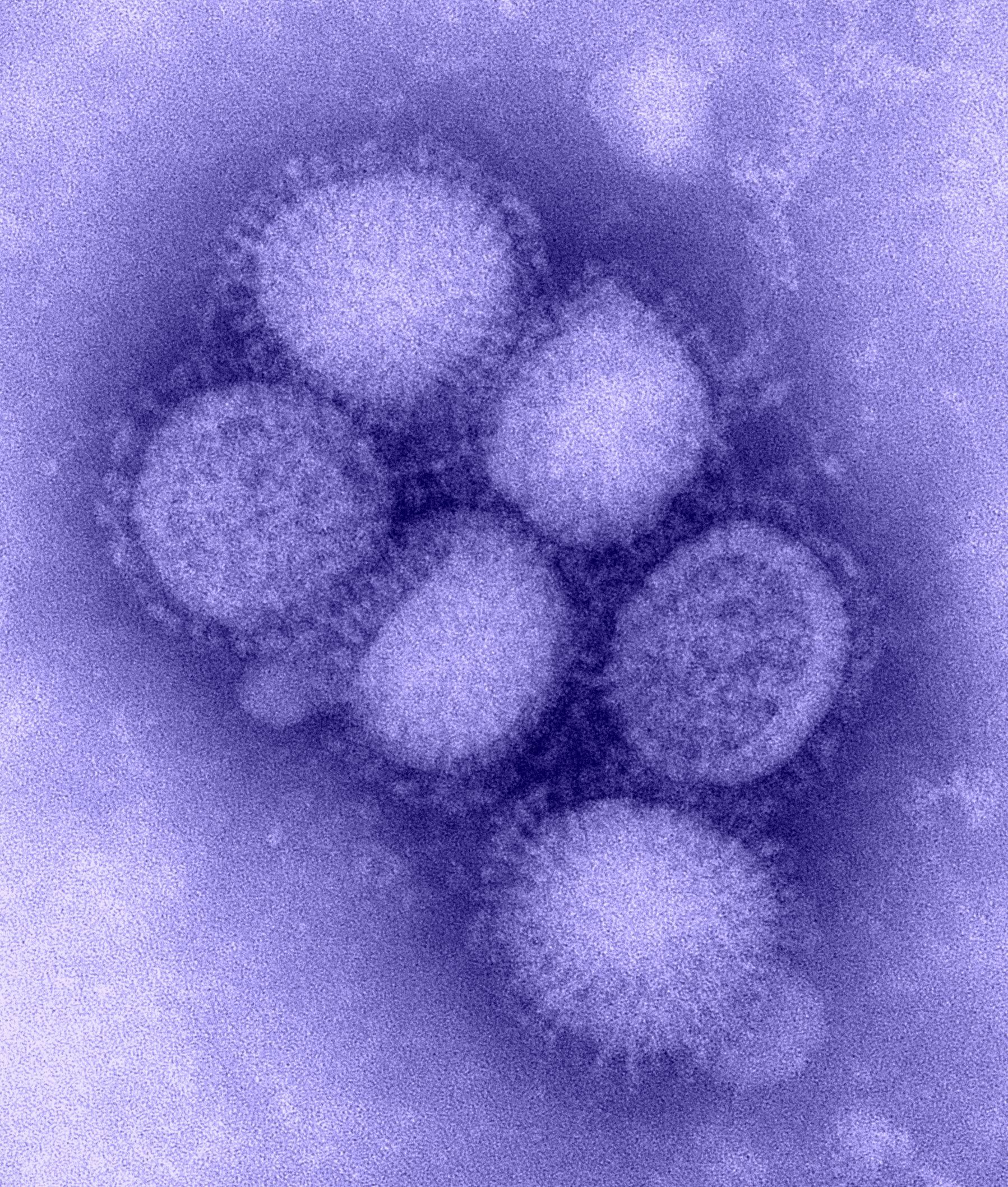 H1N1 Flu of 2009 in Canada. The Canadian Encyclopedia