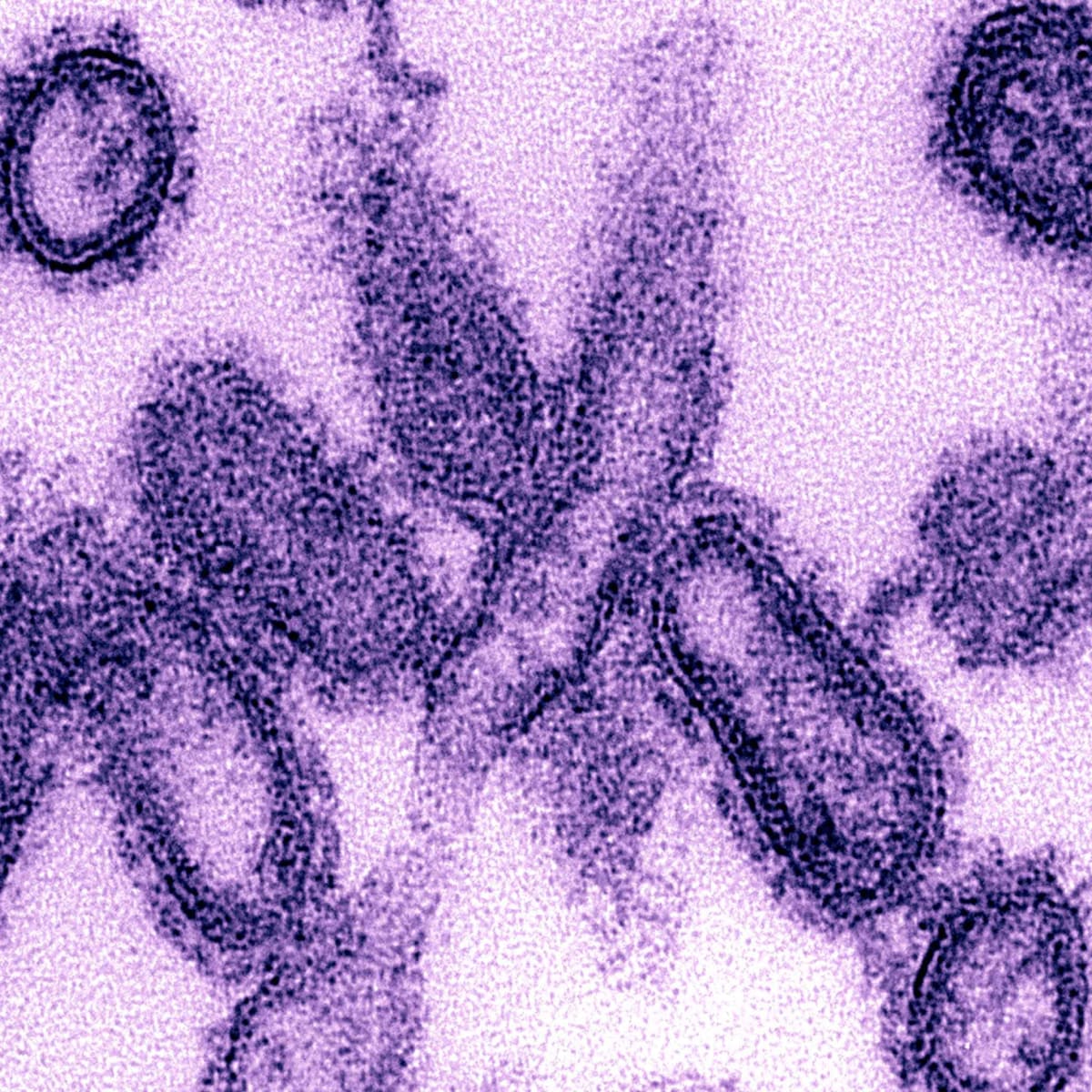 Spanish Flu, How It Began & Ended