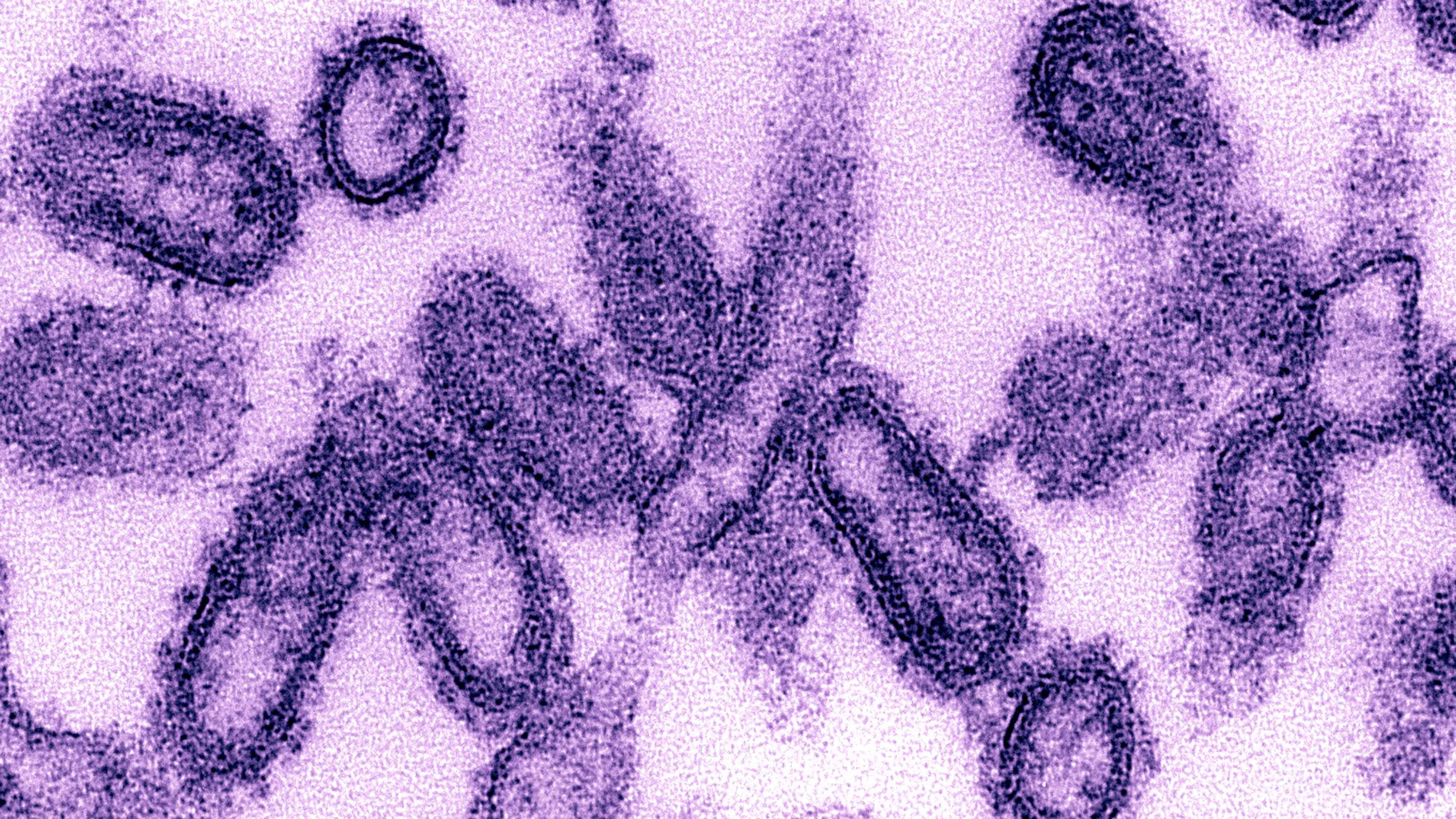 Spanish Flu, How It Began & Ended